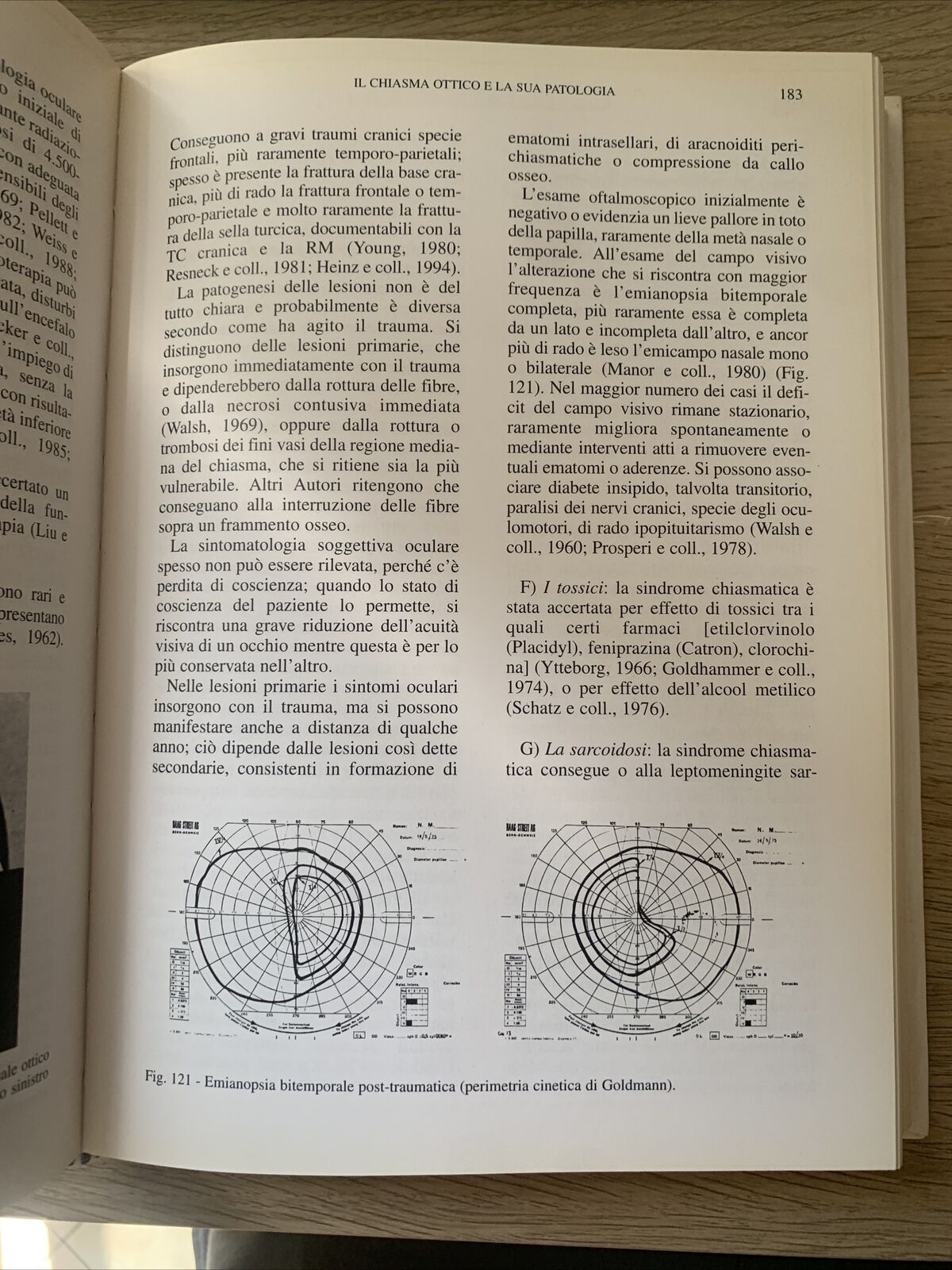 NEUROFTALMOLOGIA - FRANCESCO CARTA, EDIZIONI SBM 1997 #