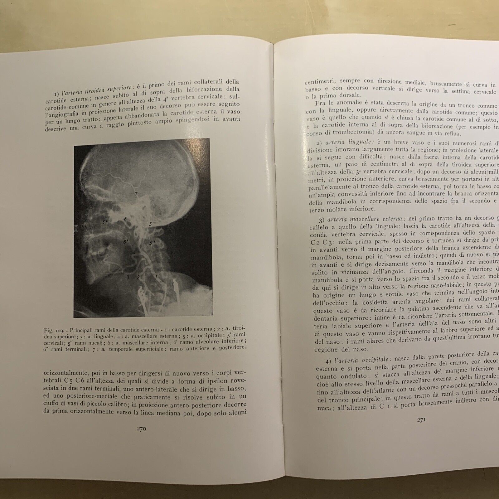 ANGIOGRAFIA CEREBRALE - MARIO MILLETTI, VOLUME PRIMO. LUIGI PARMA 1959