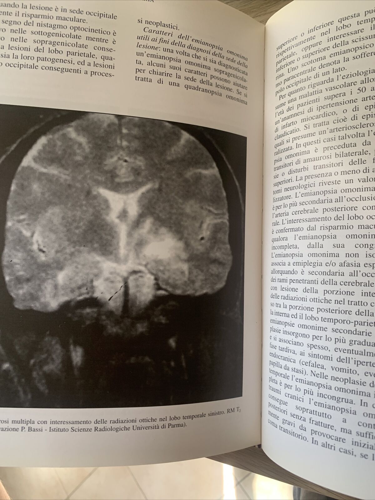 NEUROFTALMOLOGIA - FRANCESCO CARTA, EDIZIONI SBM 1997 #