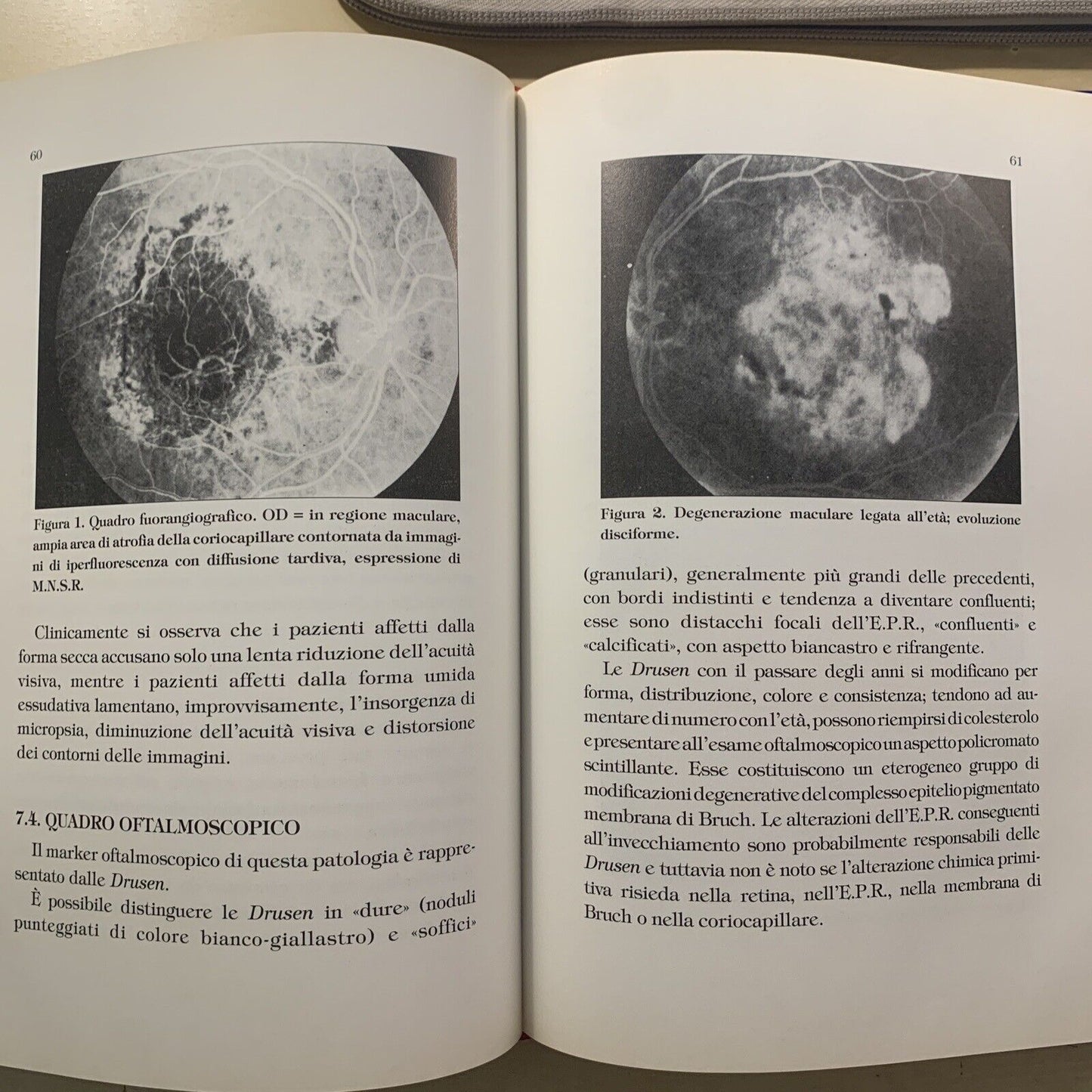 PATOLOGIA OCULARE NELL'ANZIANO - Arturo di Biase, di Benedetto. Pitagora 1995 #
