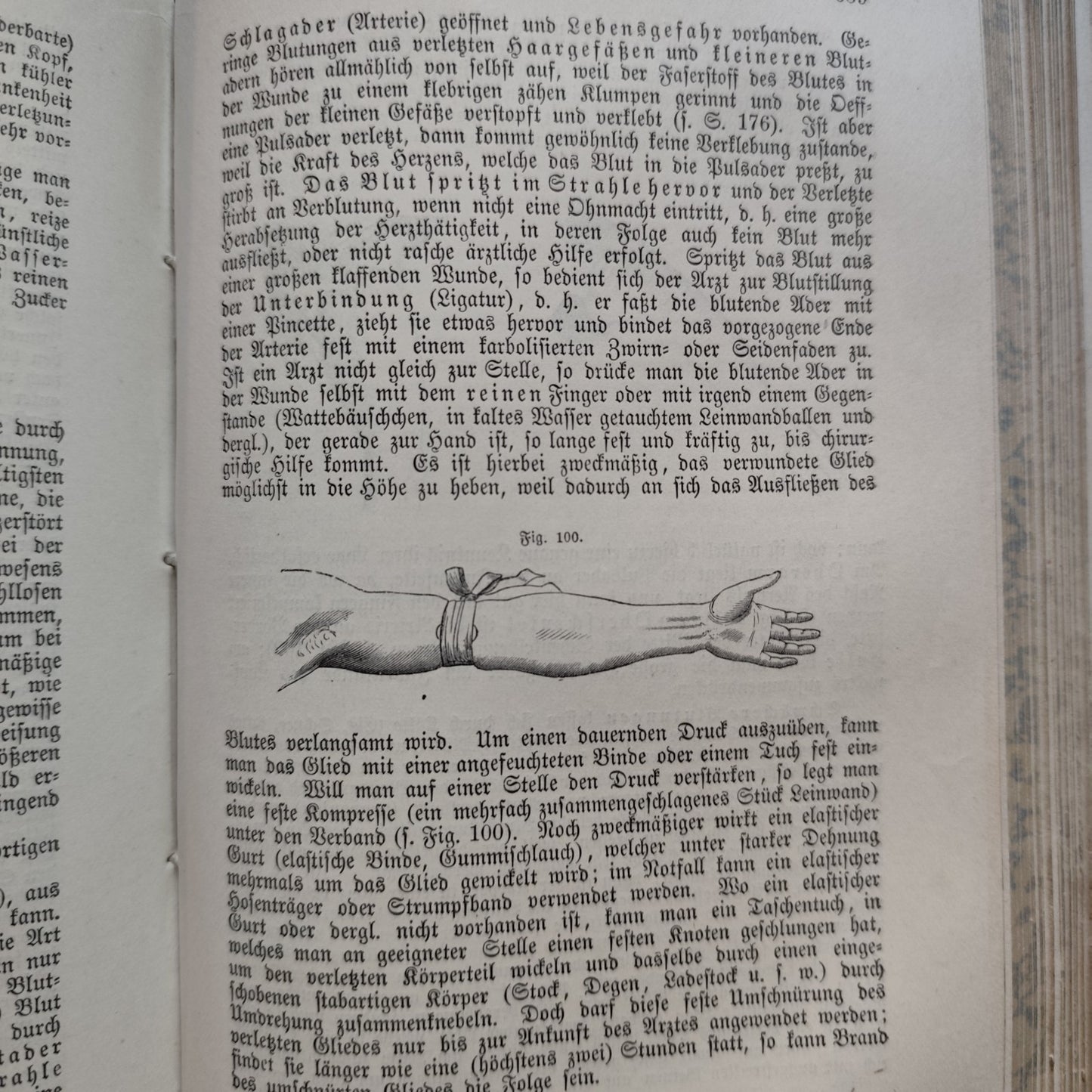 Das Buch vom Gesunden und kranken menschen - Ernst Bock 1889 Antico testo medico