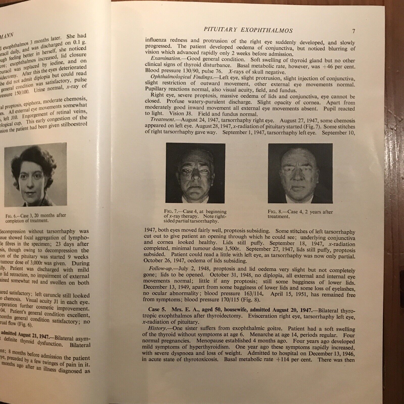 BRITISH JOURNAL OF OPHTHALMOLOGY oftalmologia, vol. XXXVI 1952 - S. Duke-Elder