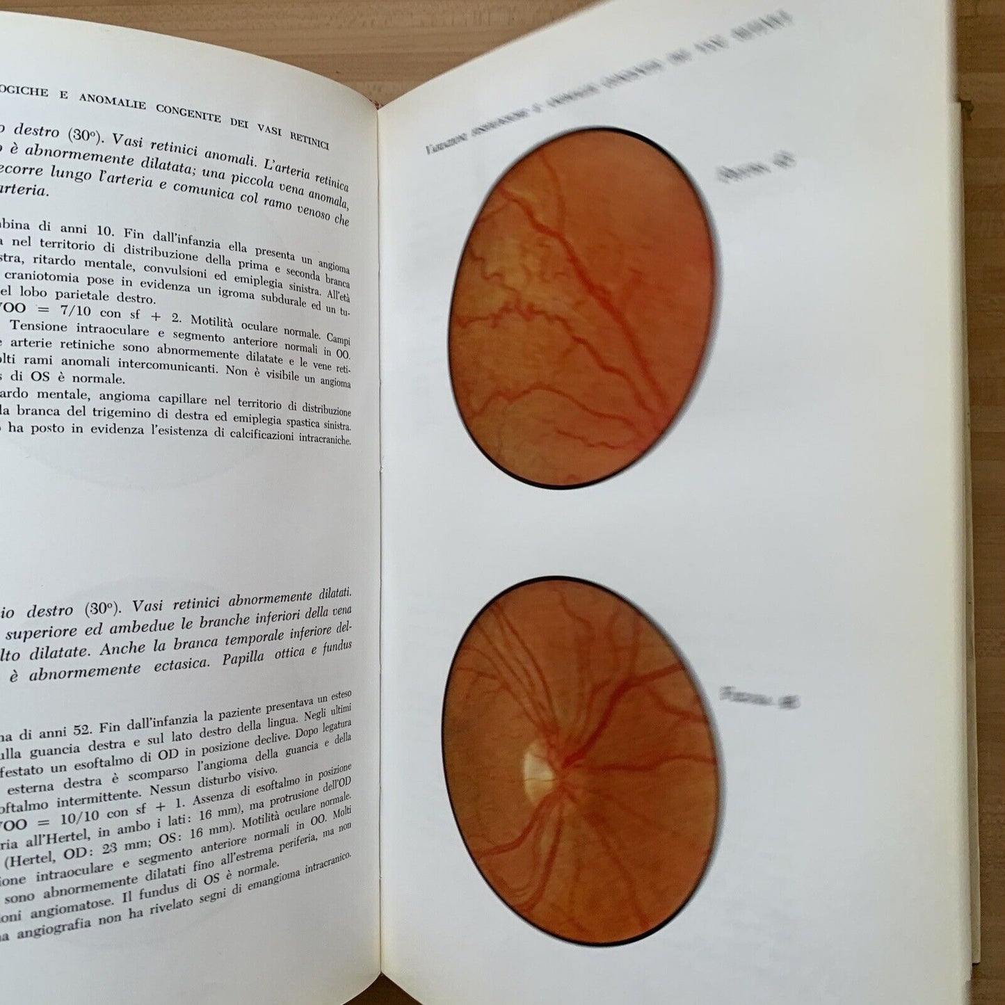 ATLANTE DEL FONDO DELL'OCCHIO - H. W. LARSEN. Luigi Russo editore 1964