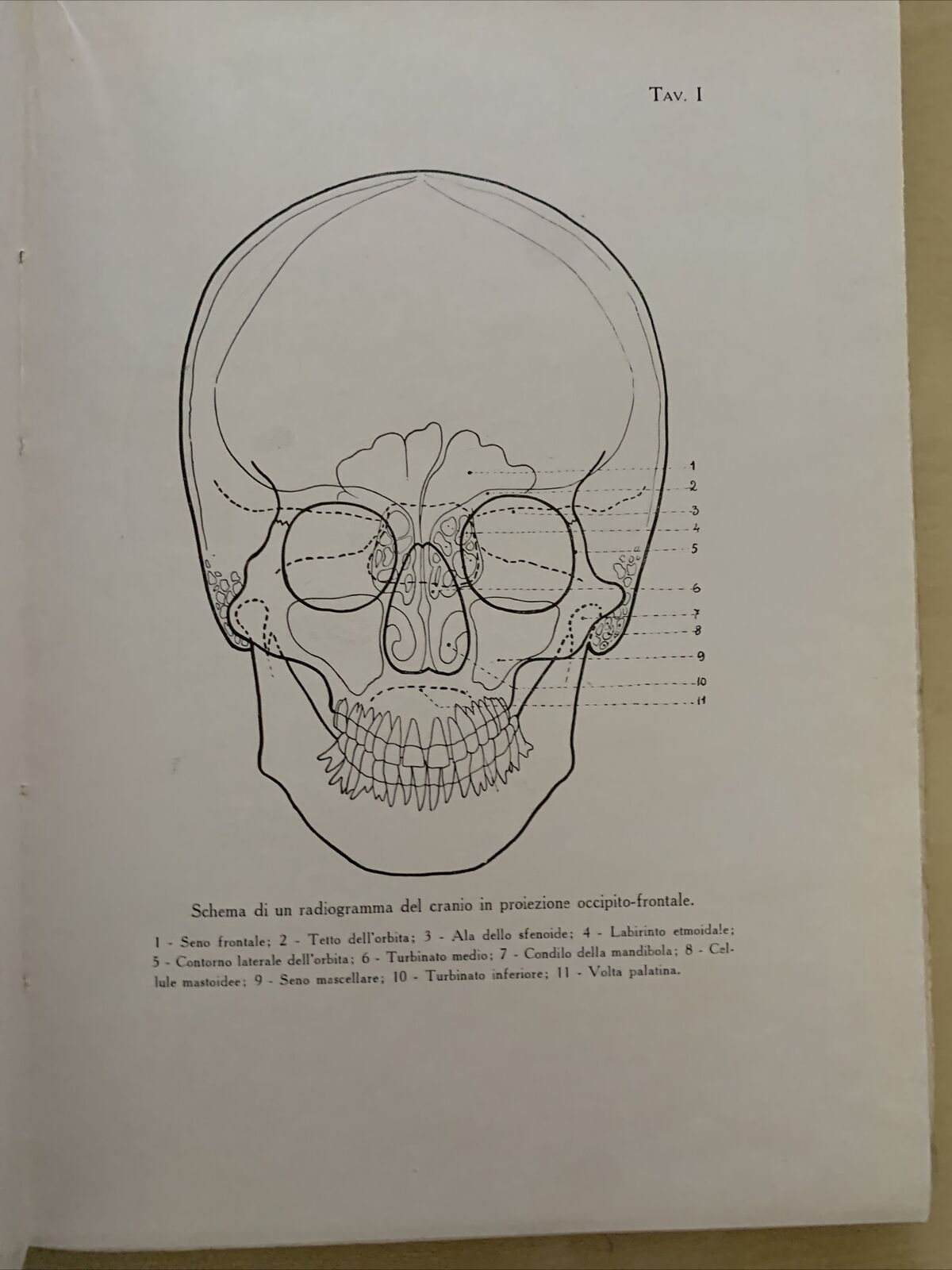 LA RADIOLOGIA IN OTORINO LARINGOLOGIA. G. LASCHI, VIGI. CAPPELLI 1931 #