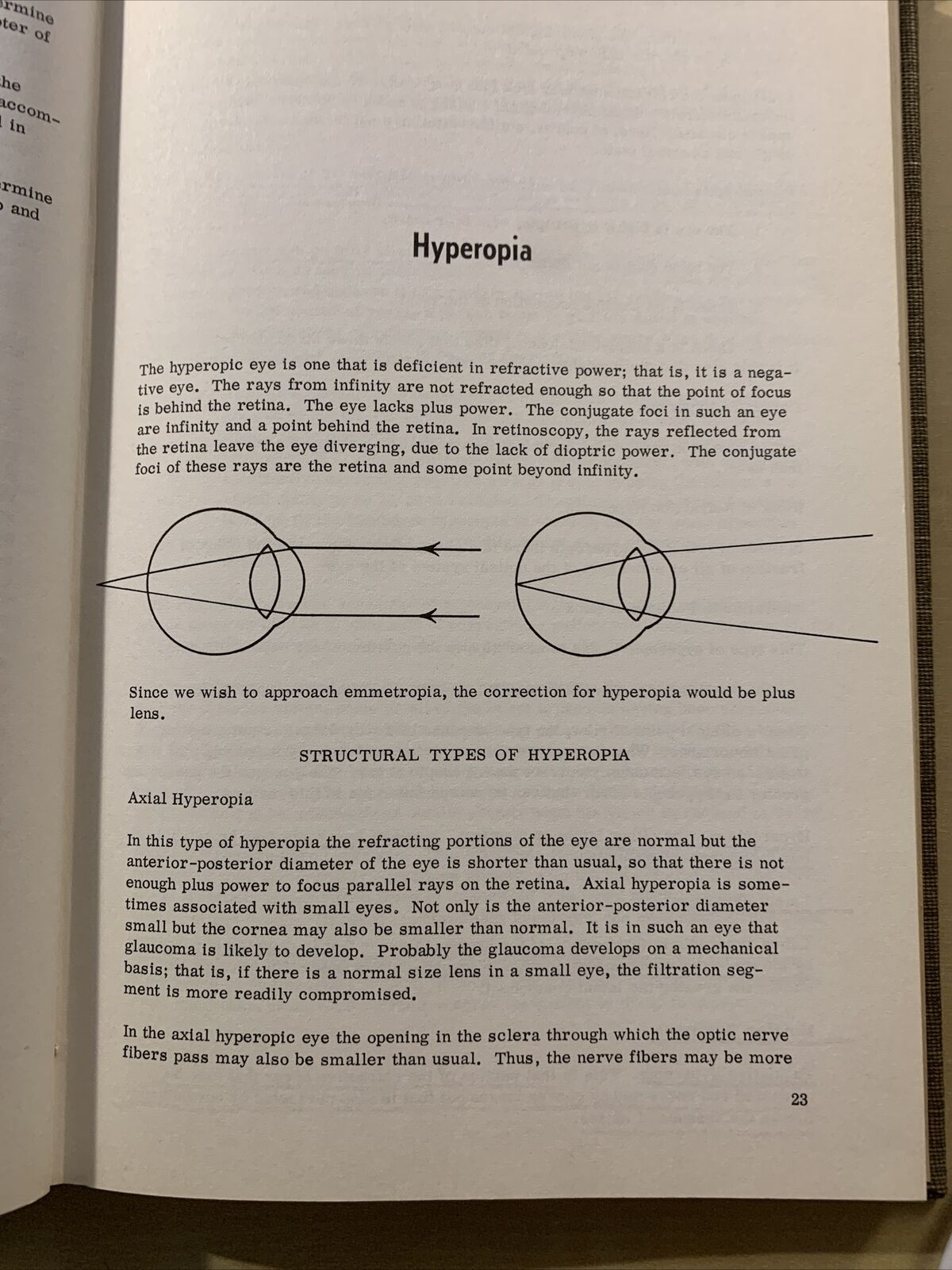 MANUAL OF REFRACTION - ALBERT E. SLOANE  1961 #