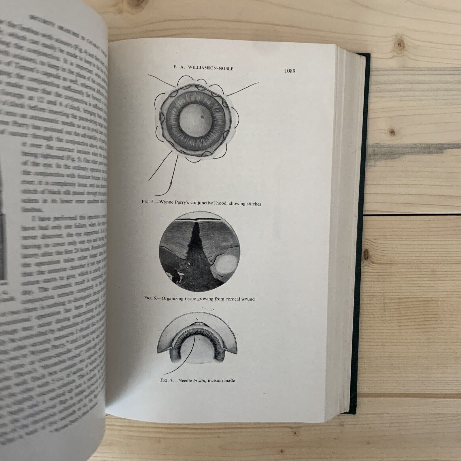 CONCILIUM OPHTHALMOLOGICUM XVI 1950 Britannia. Acta vol. II British Medical  #