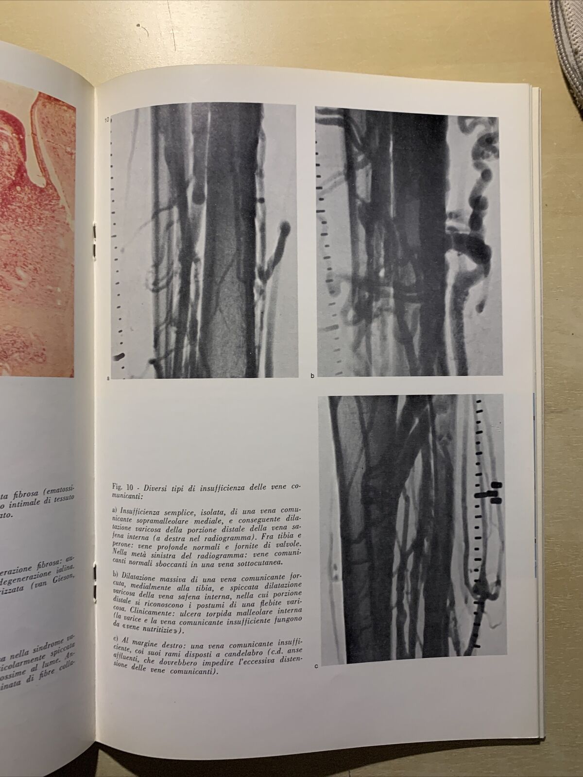 SIMPOSI CLINICI VOLUME 5 NUMERO 4 - 1968 #
