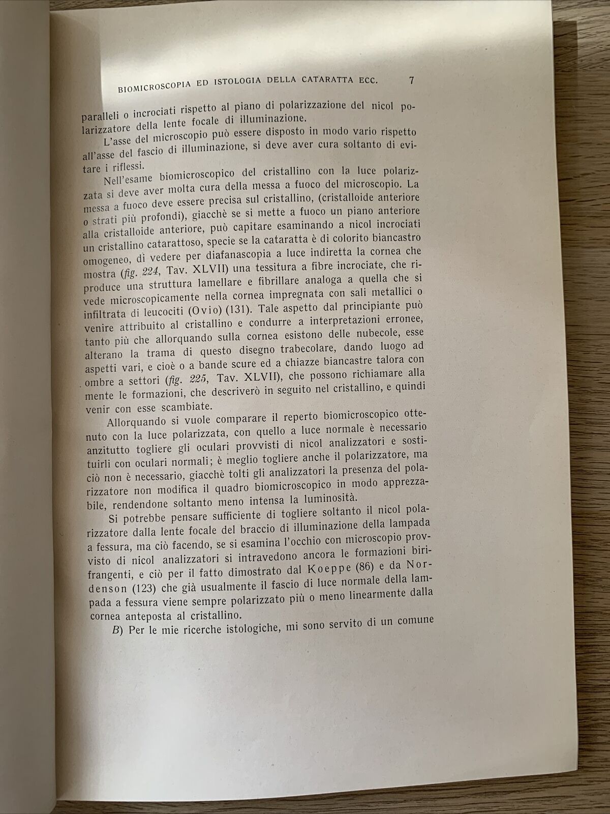 BIOMICROSCOPIA ED ISTOLOGIA DELLA CATARATTA A LUCE POLARIZZATA - Strampelli 1934
