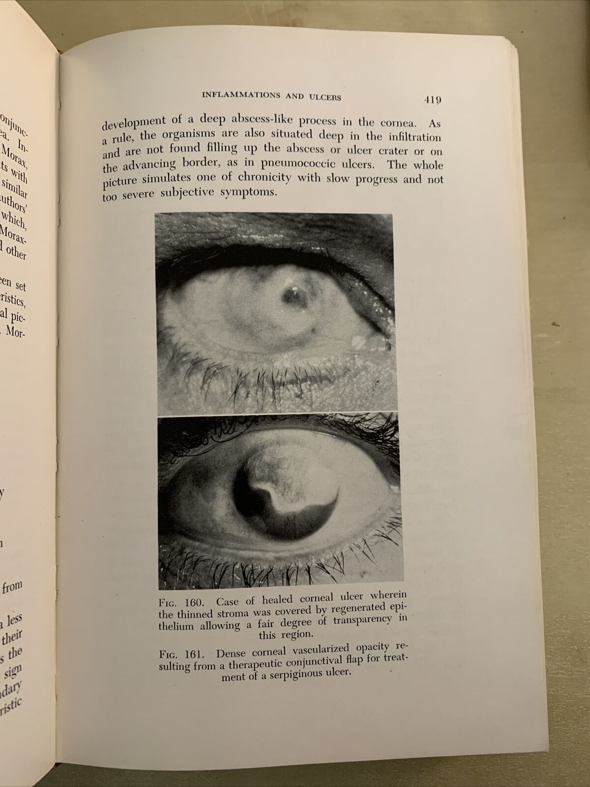 THE CORNEA - CHARLES THOMAS M. D.