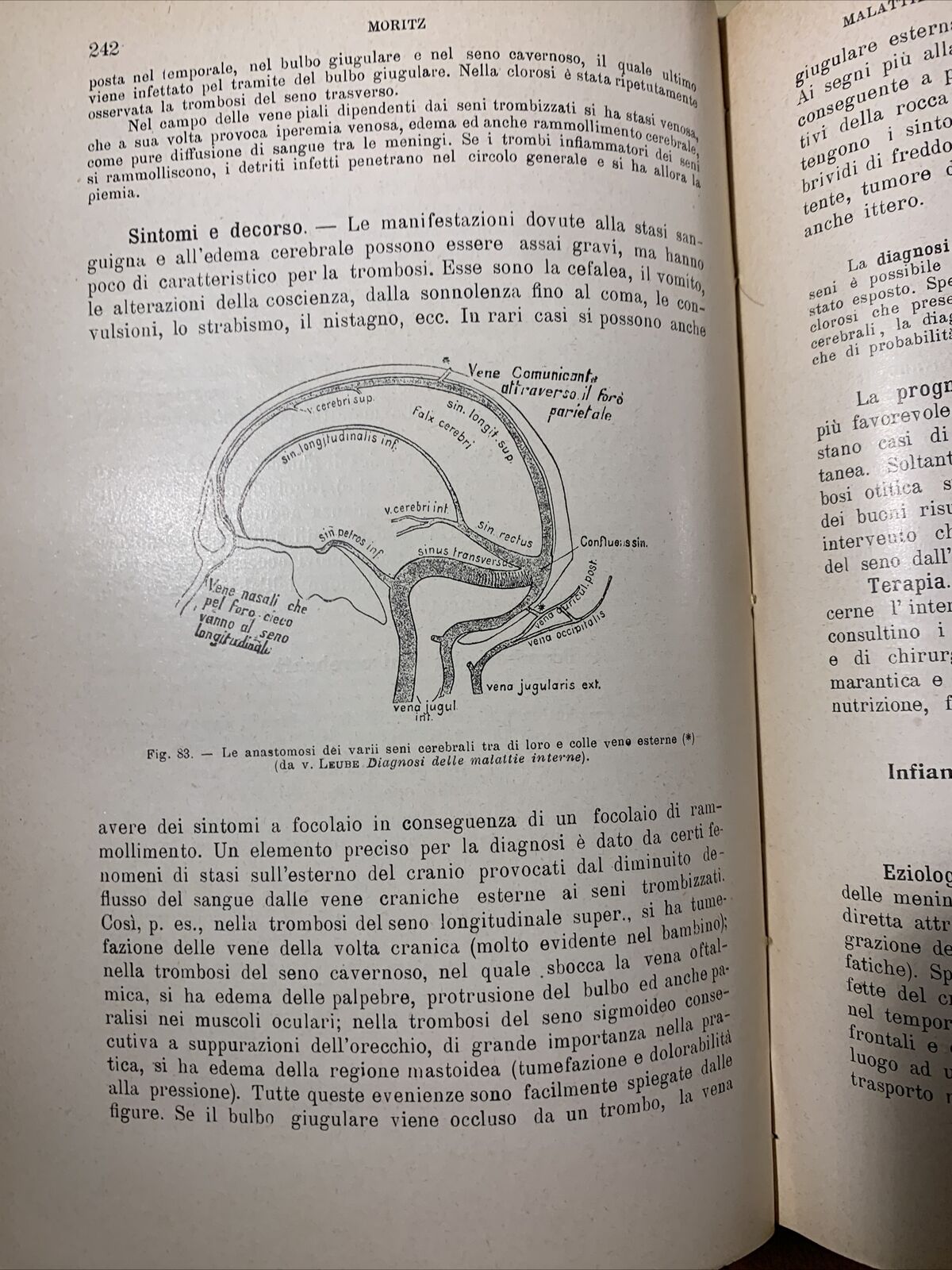 TRATTATO DELLE MALATTIE INTERNE, J. v. Mering. Società Editrice Libraria 1926