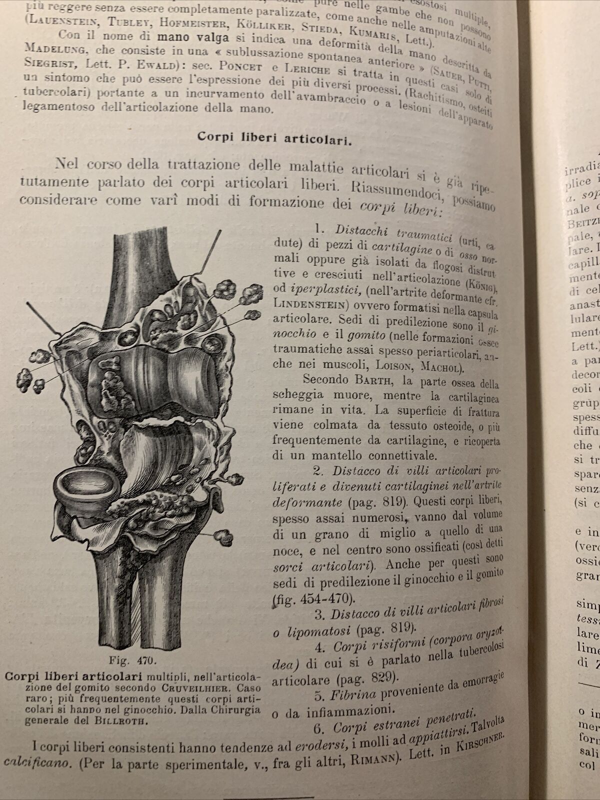 Trattato di ANATOMIA PATOLOGICA SPECIALE - Kaufmann E. Vallardi 1913 2 voll. #