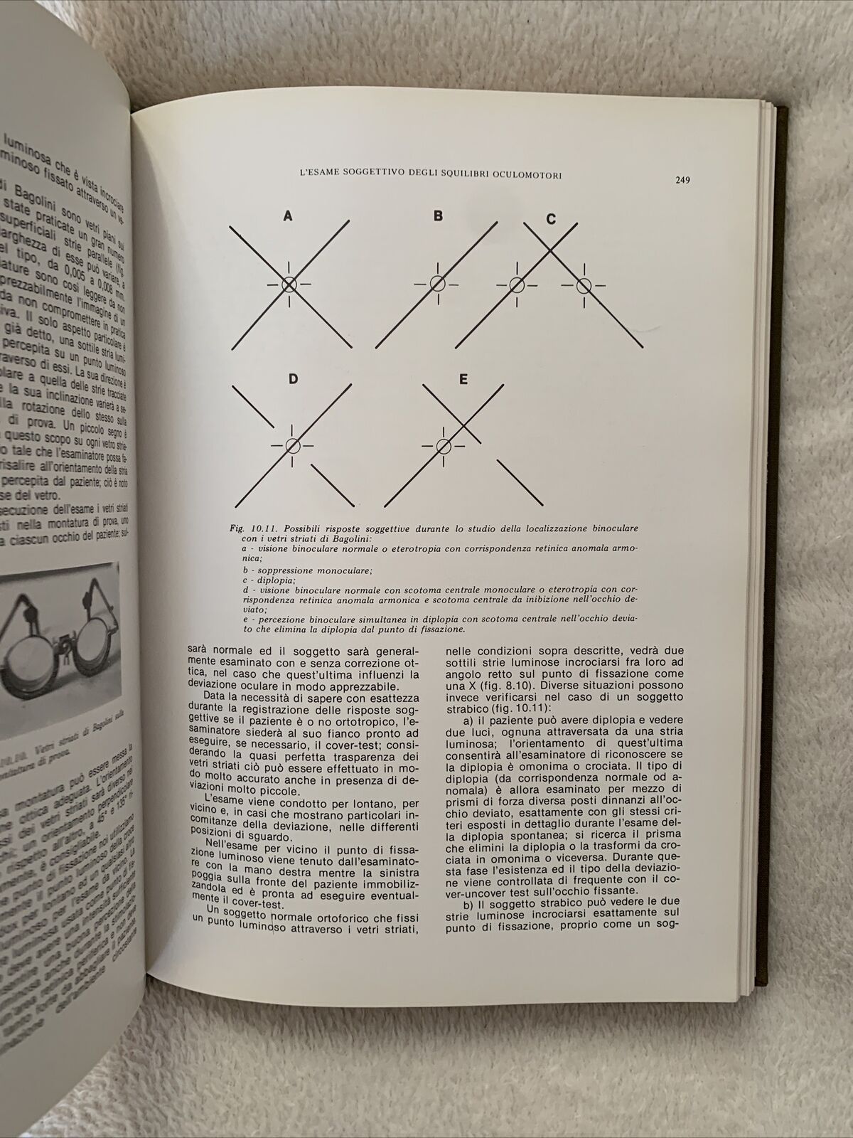 L'UNITÀ VISIVA SENSORIO-MOTORIA fisiopatologia e clinica dello strabismo. Maione