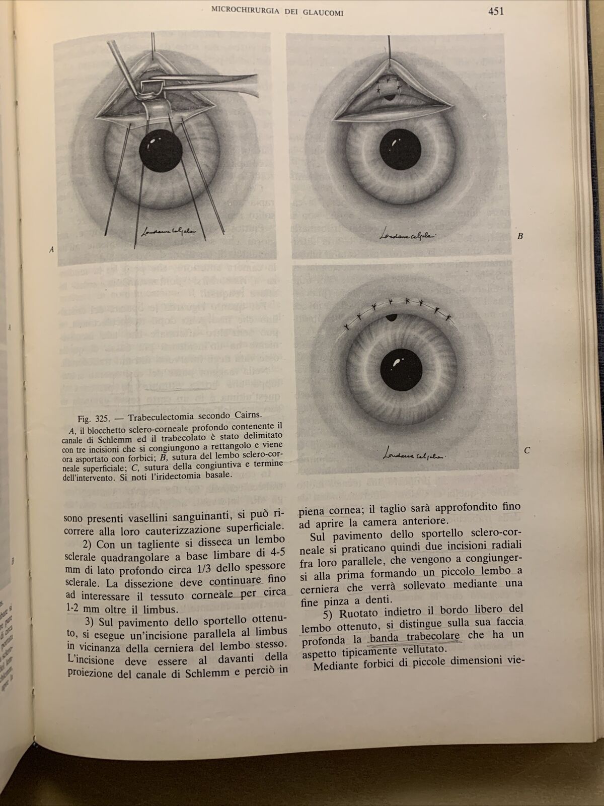 Tecnica Chirurgica. Chirurgia Oculistica UTET volume 10 - 1984 #