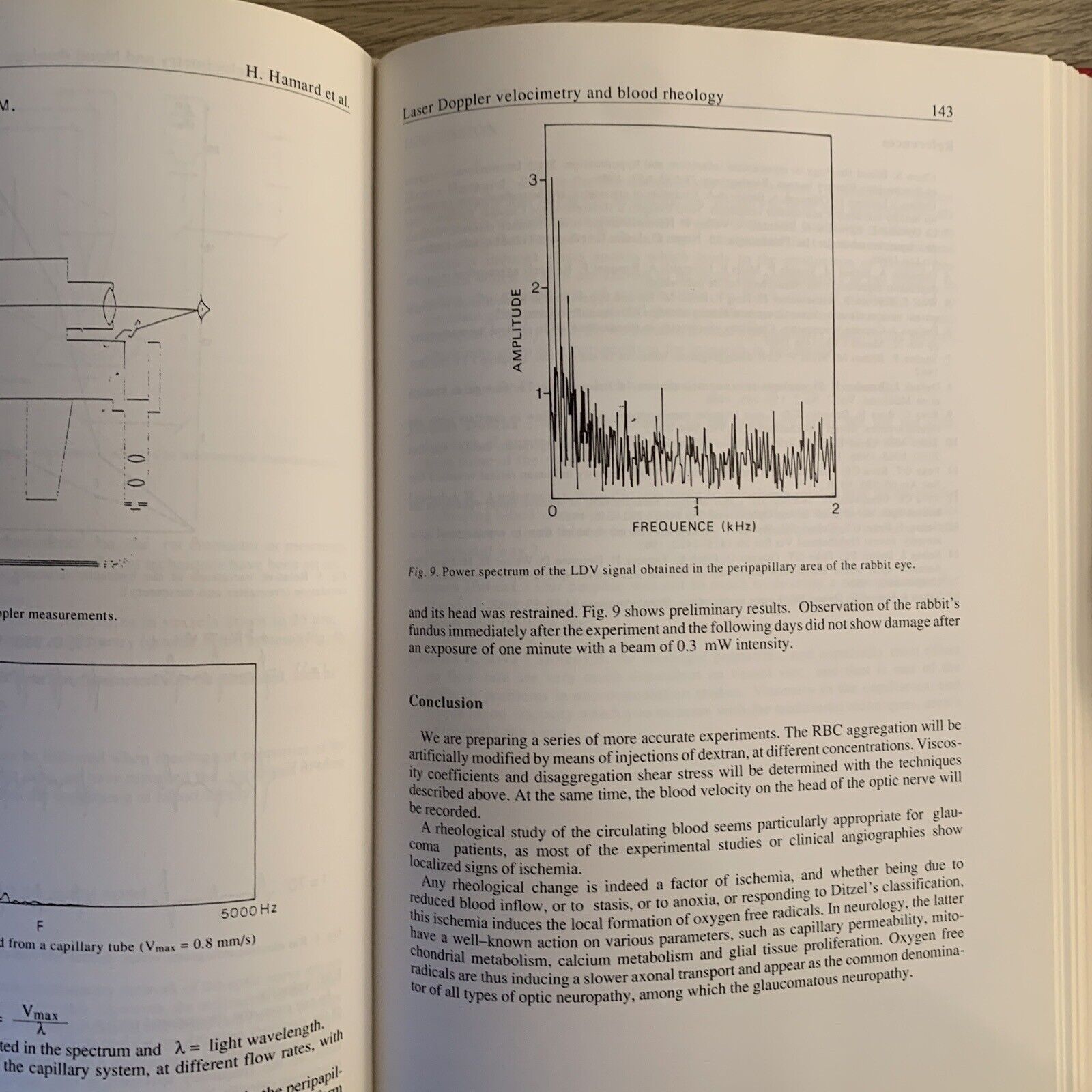 OCULAR BLOOD FLOW IN GLAUCOMA means methods and measurements. Lambrou L. Greve