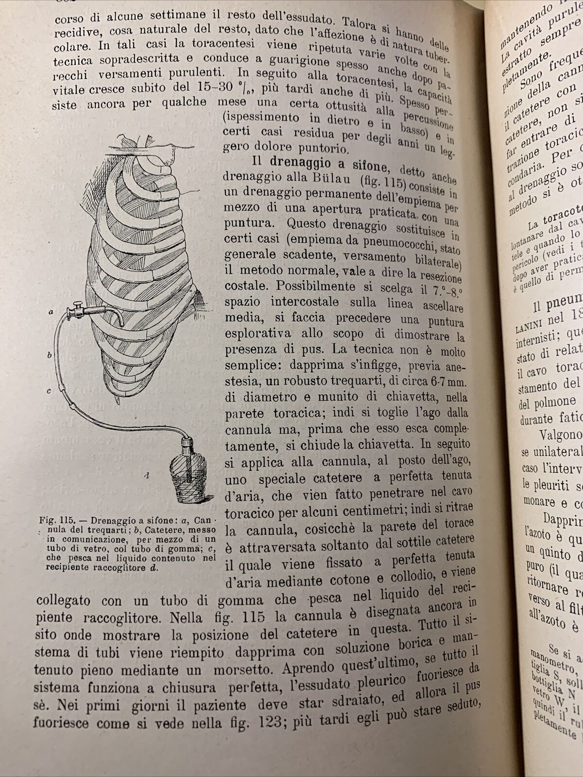 TRATTATO DELLE MALATTIE INTERNE, J. v. Mering. Società Editrice Libraria 1926