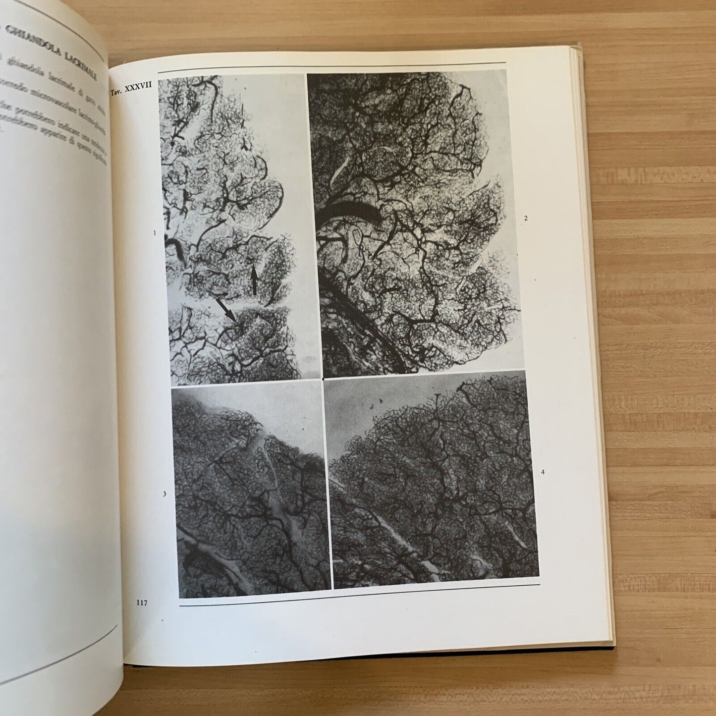 L'OCCHIO - parte terza volume primo. microvascolarizzazione. Morone, Ottaviani