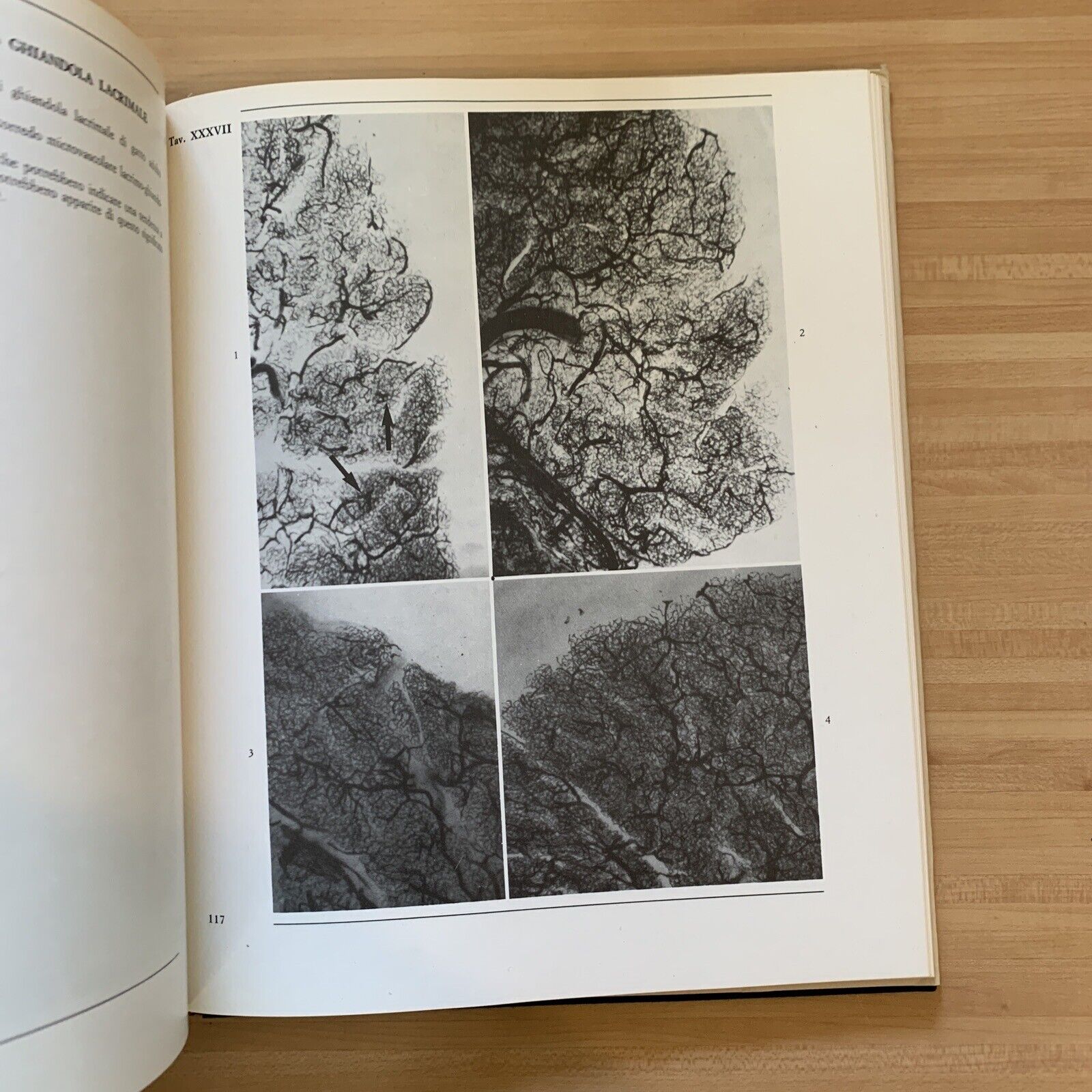 L'OCCHIO - parte terza volume primo. microvascolarizzazione. Morone, Ottaviani