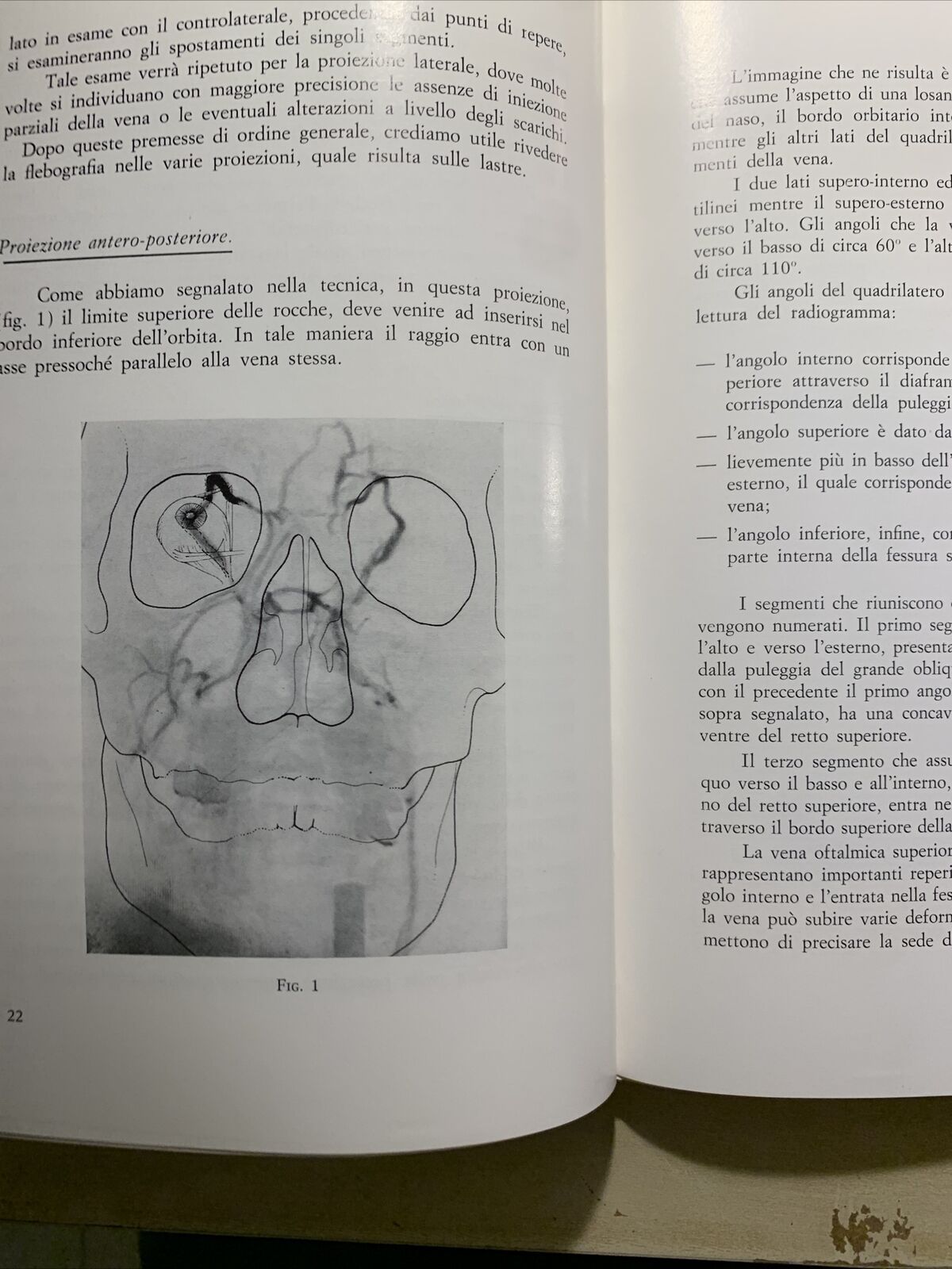 STATO ATTUALE DELLA FLEBOGRAFIA ORBITARIA - CRISTINI, CARAMAZZA, GIORDANO #