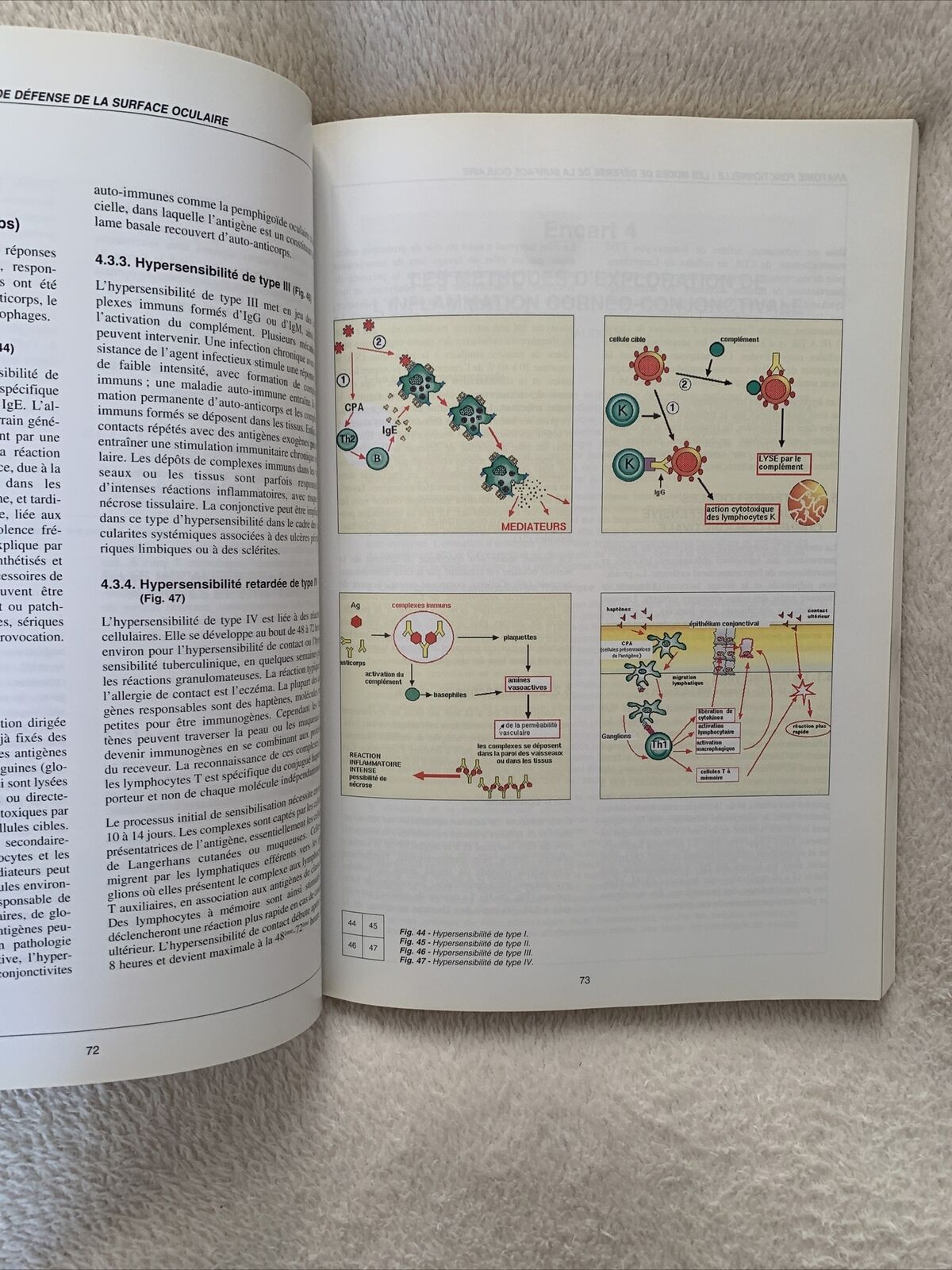 Inflammation chronique de la conjonctive, Thanh Hoang-Xuan, Hannouche, Badouin