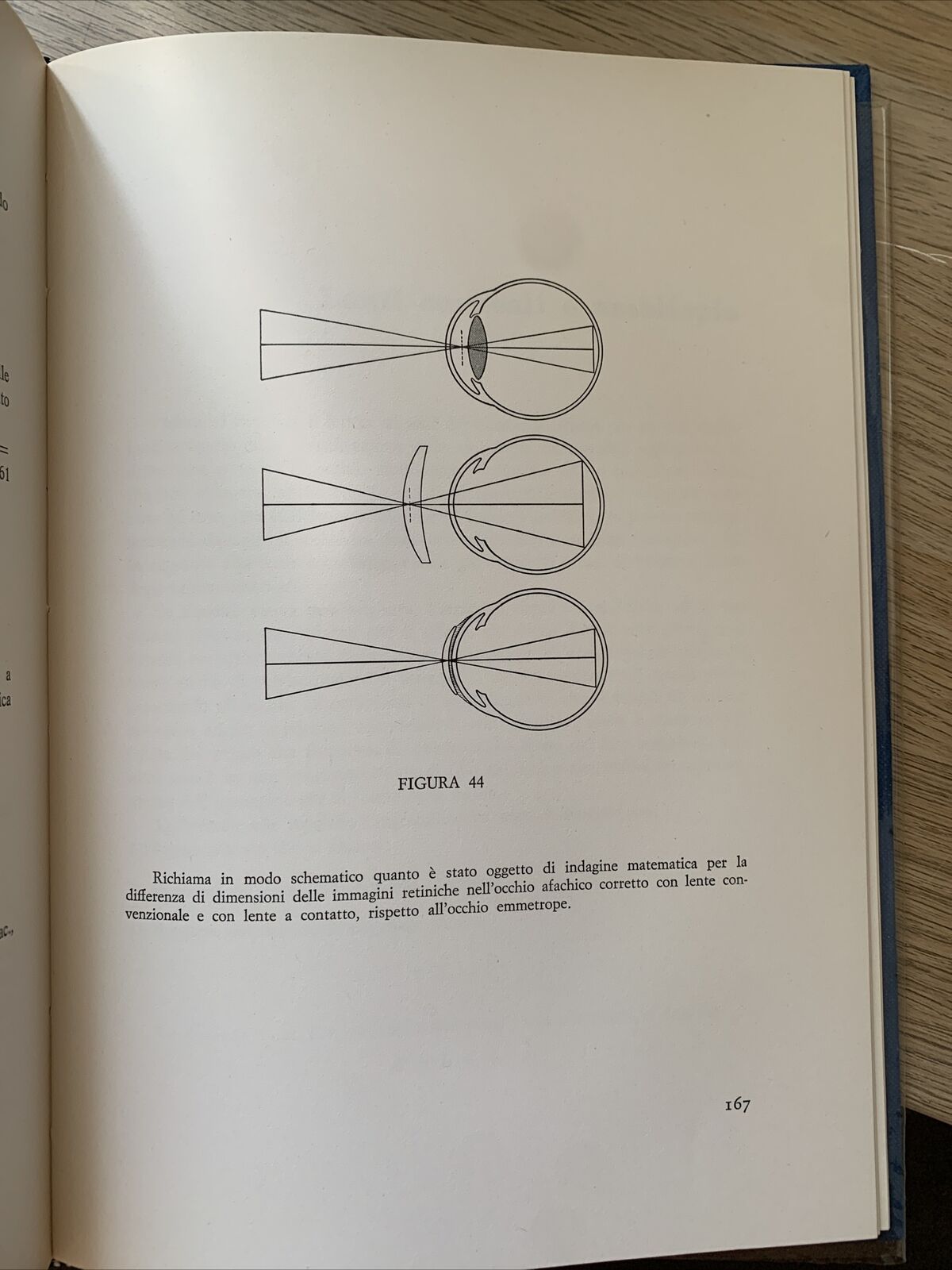 TECNICA E PRATICA DELLE LENTI A CONTATTO - ALDO ZOLDAN, REBELLATO EDITORE 1967 #