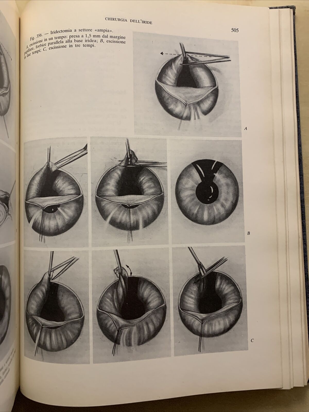 Tecnica Chirurgica. Chirurgia Oculistica UTET volume 10 - 1984 #