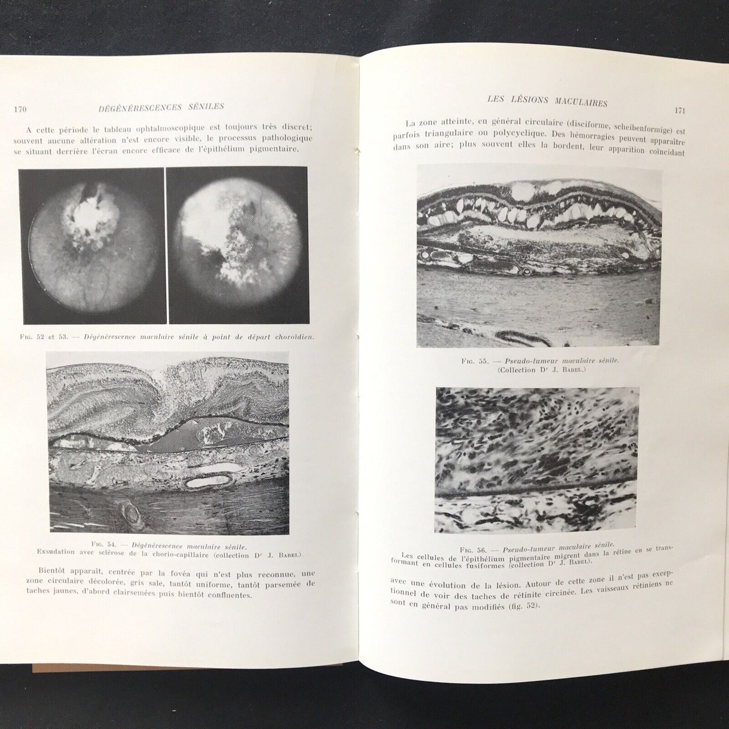 LES AFFECTIONS DE LA MACULA, Jean P. Bailliart - Masson & Cie