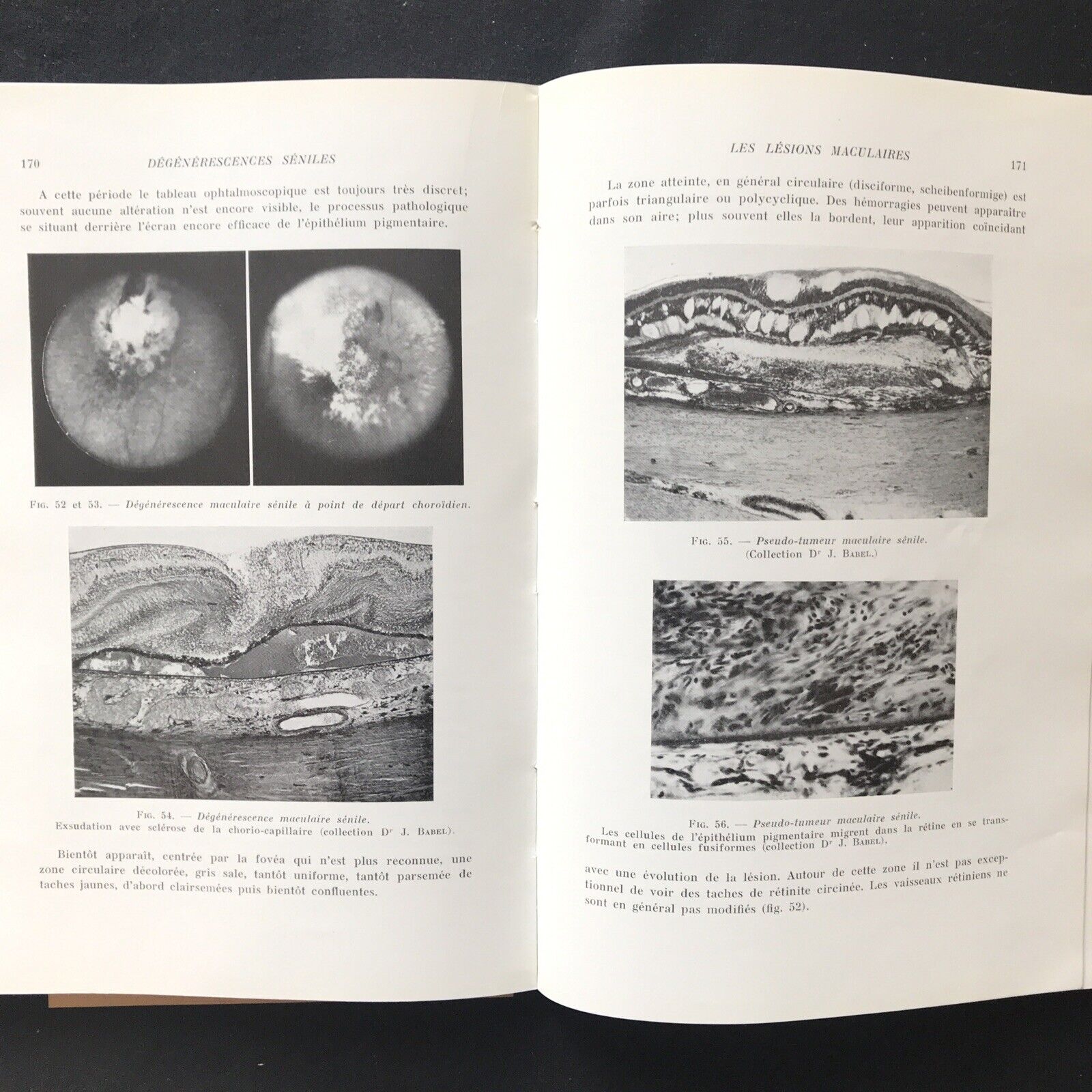 LES AFFECTIONS DE LA MACULA, Jean P. Bailliart - Masson & Cie