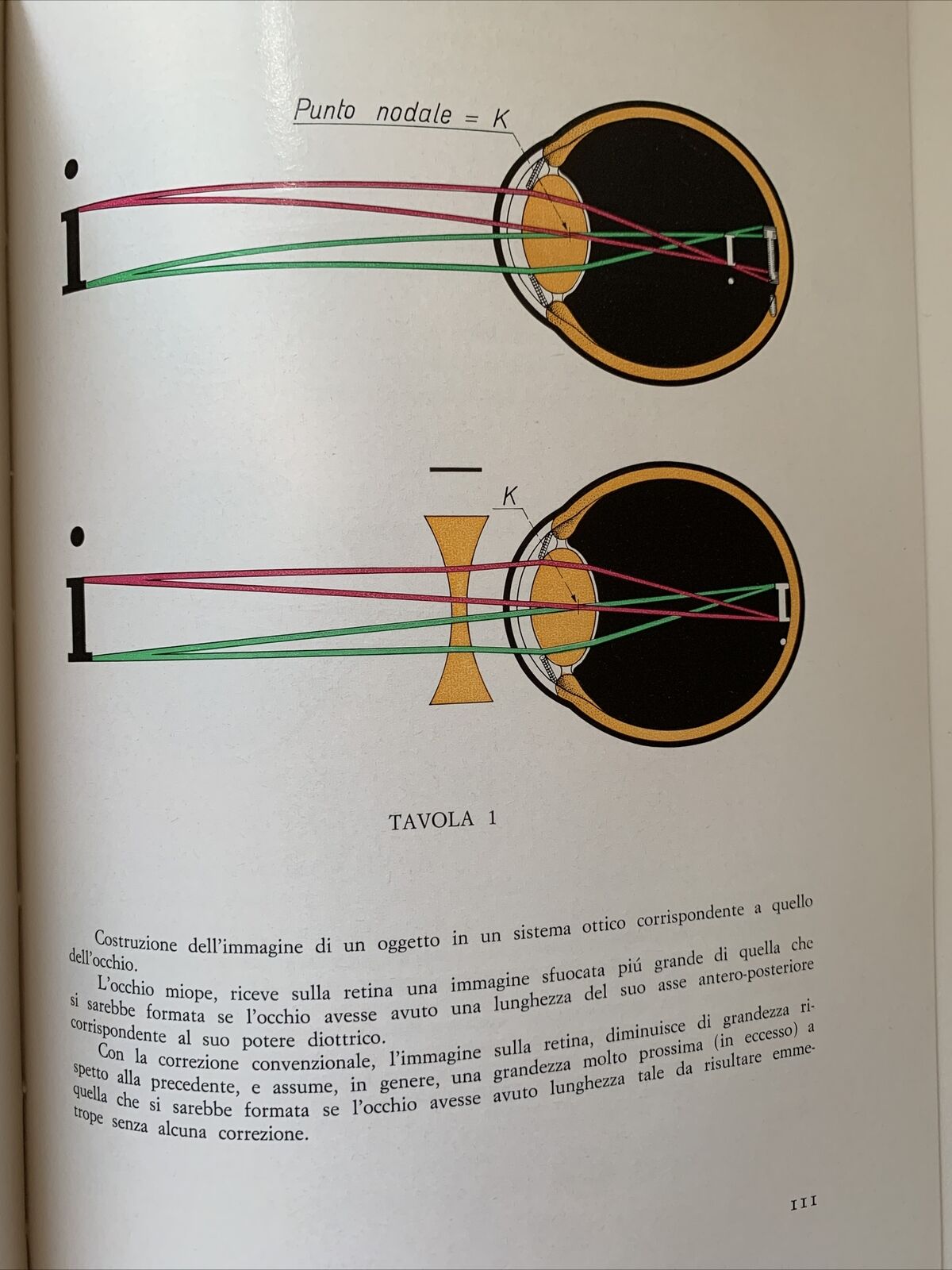 TECNICA E PRATICA DELLE LENTI A CONTATTO - ALDO ZOLDAN, REBELLATO EDITORE 1967 #