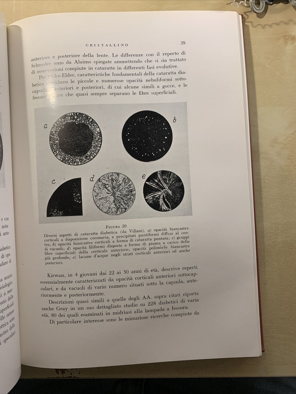 L'OCCHIO NEL DIABETE MELLITO - ALAGNA, SCULLICA, CASA EDITRICE G. D'ANNA 1956 #