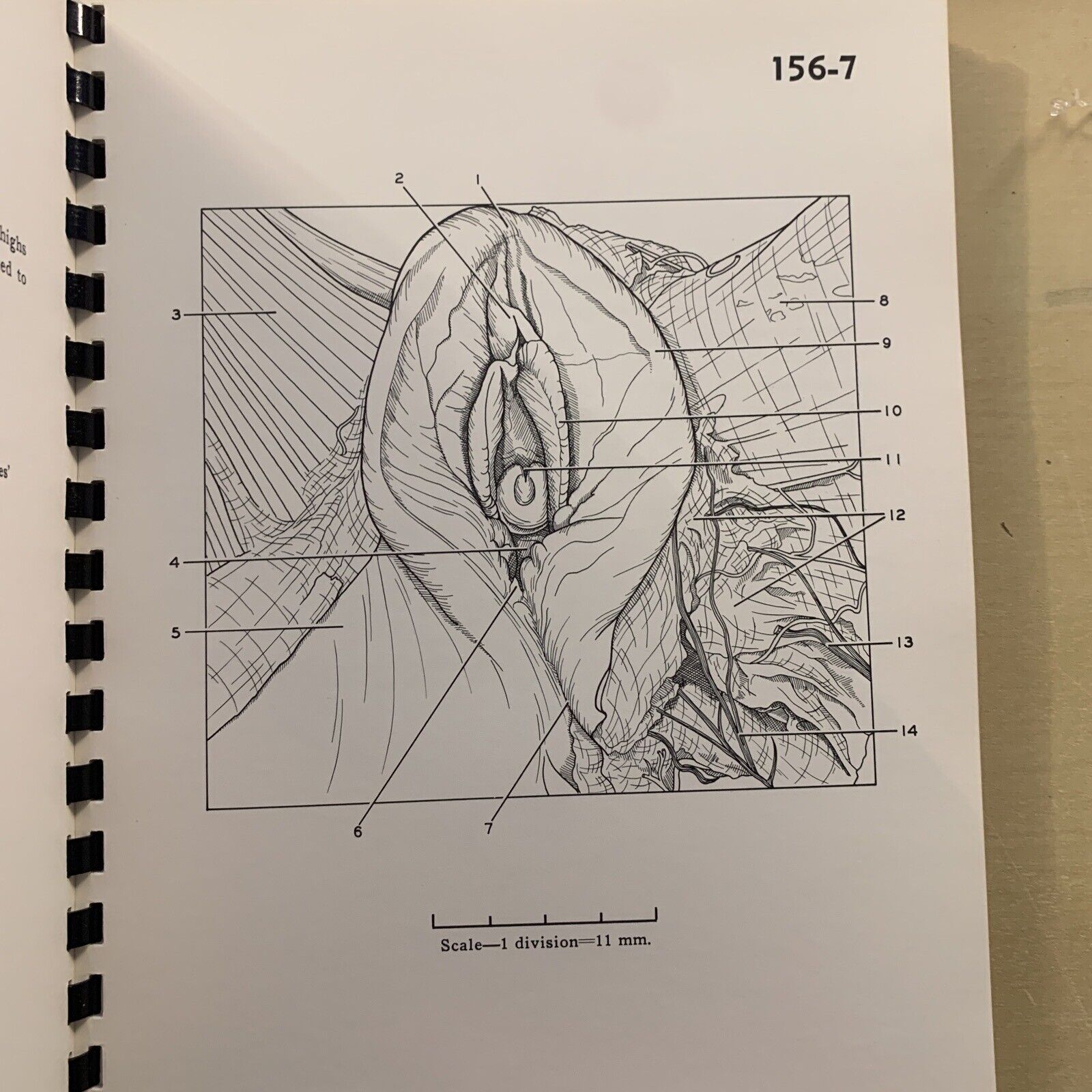 A STEREOSCOPIC ATLAS OF HUMAN ANATOMY - David Bassett section VI The pelvis #