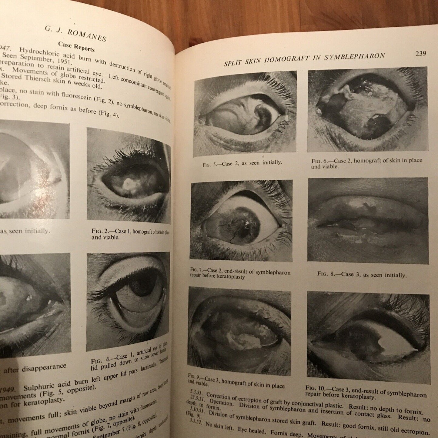 BRITISH JOURNAL OF OPHTHALMOLOGY oftalmologia, vol. XXXVII 1953 - S. Duke-Elder