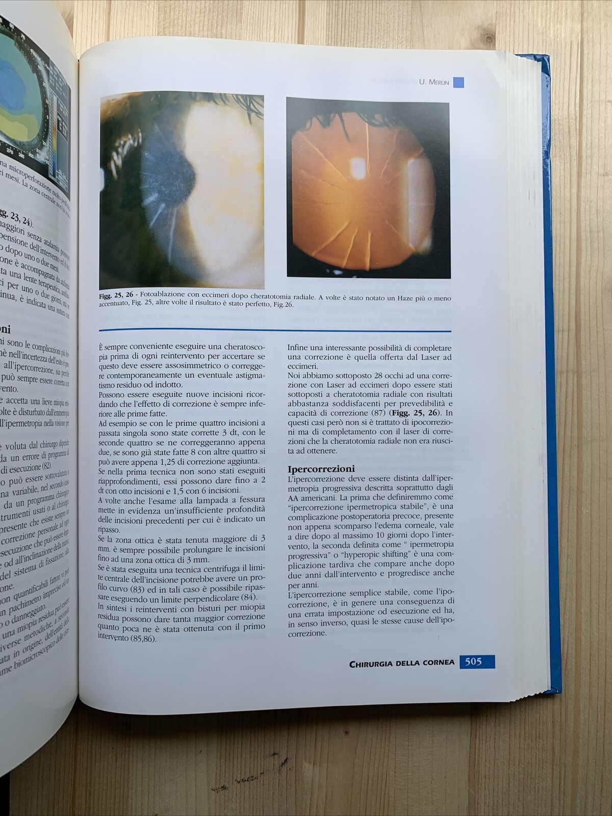 Chirurgia della Cornea - G. Rama, Società Oftalmologica Italiana. Fogliazza #