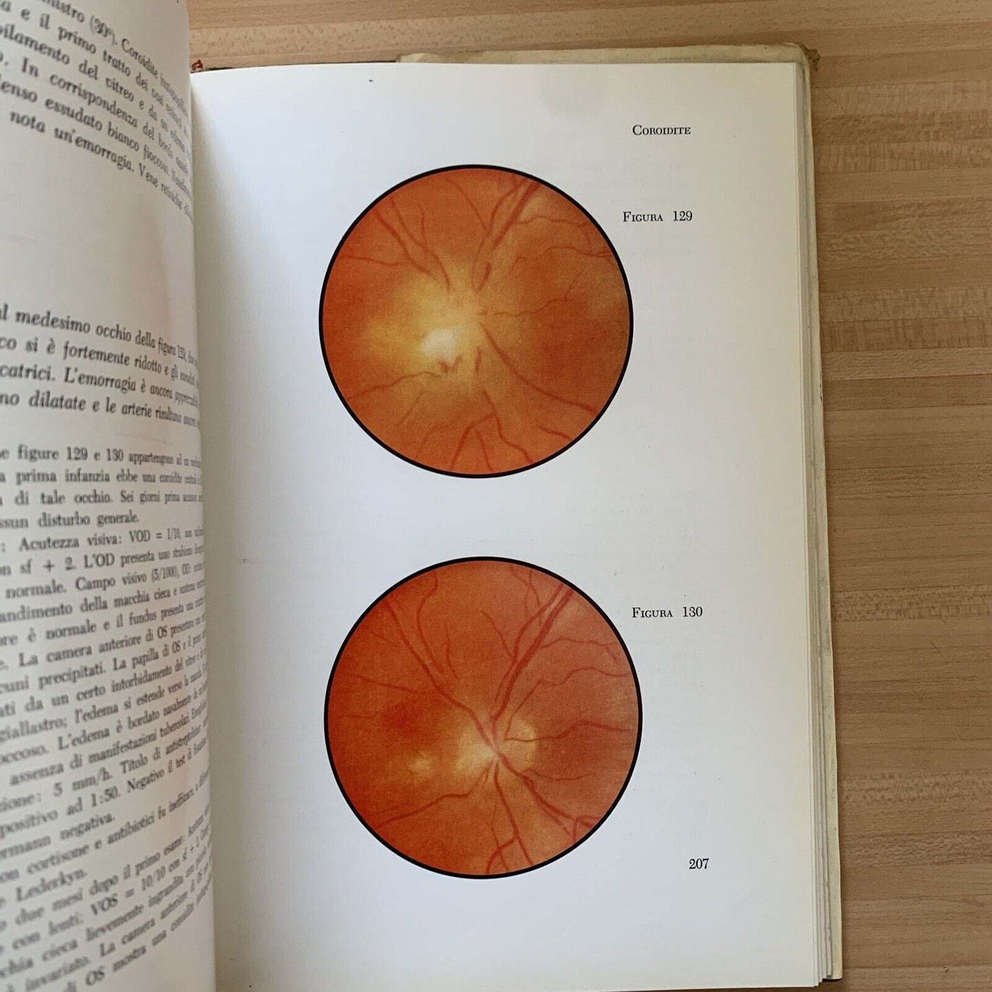 ATLANTE DEL FONDO DELL'OCCHIO - H. W. LARSEN. Luigi Russo editore 1964