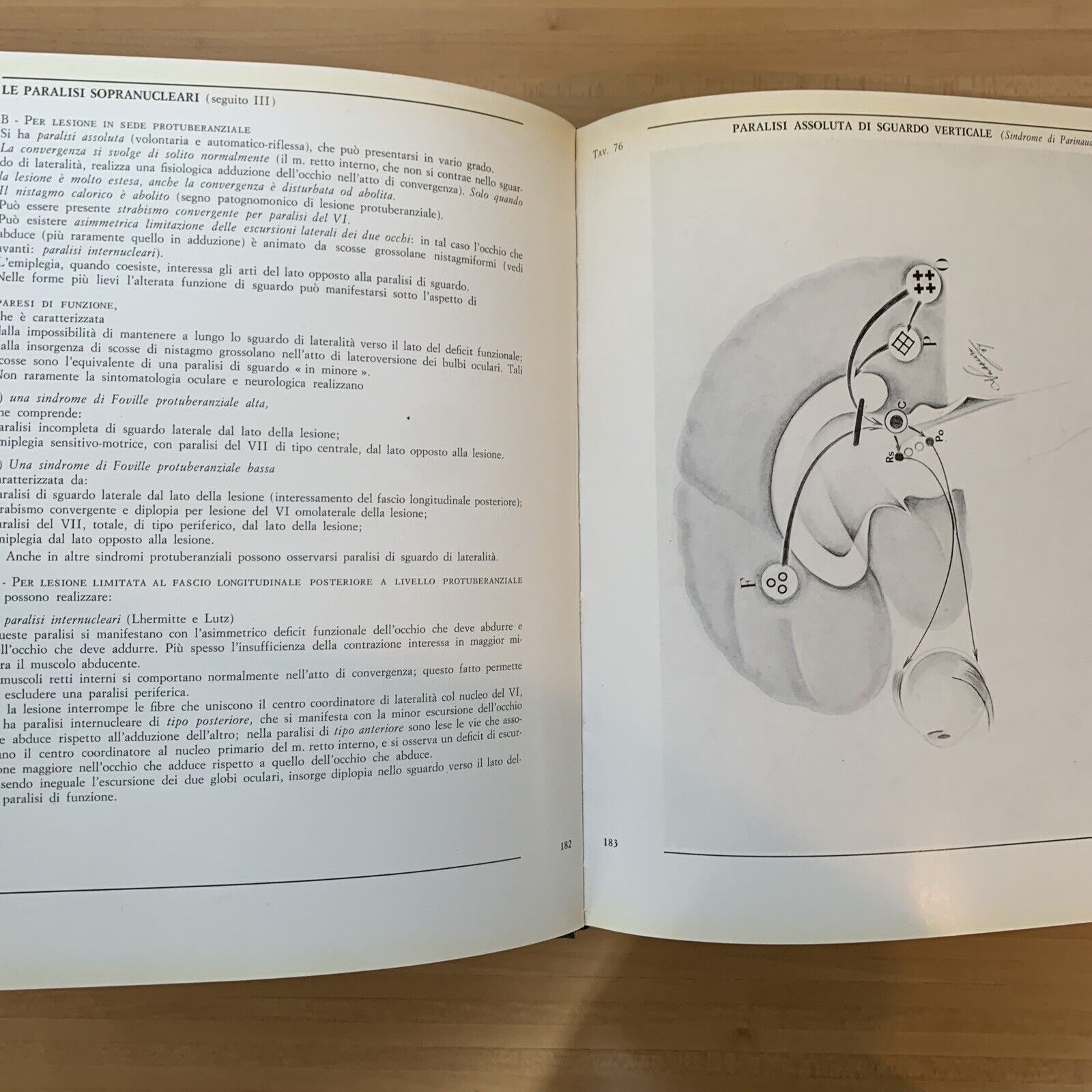 L'OCCHIO ICONOGRAFIA NEUROFTALMOLOGICA. parte seconda vol. 1 e2. Giorgio Vassura