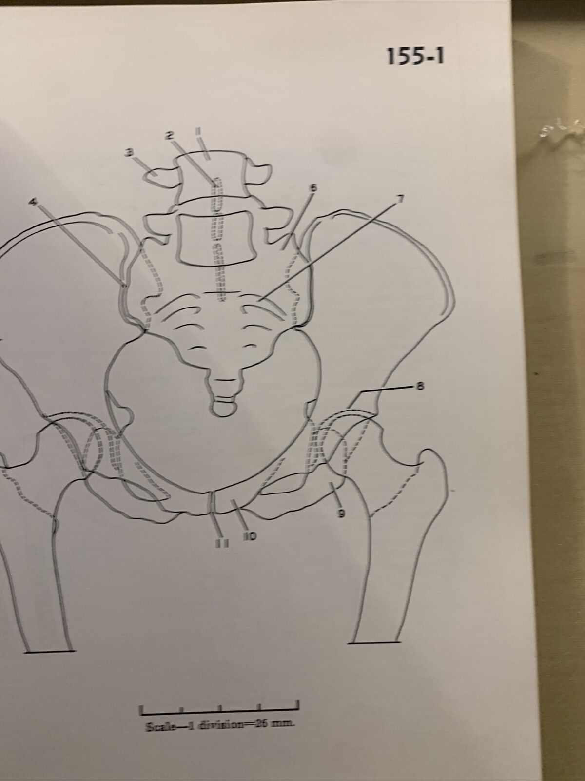 A STEREOSCOPIC ATLAS OF HUMAN ANATOMY - David Bassett section VI The pelvis #