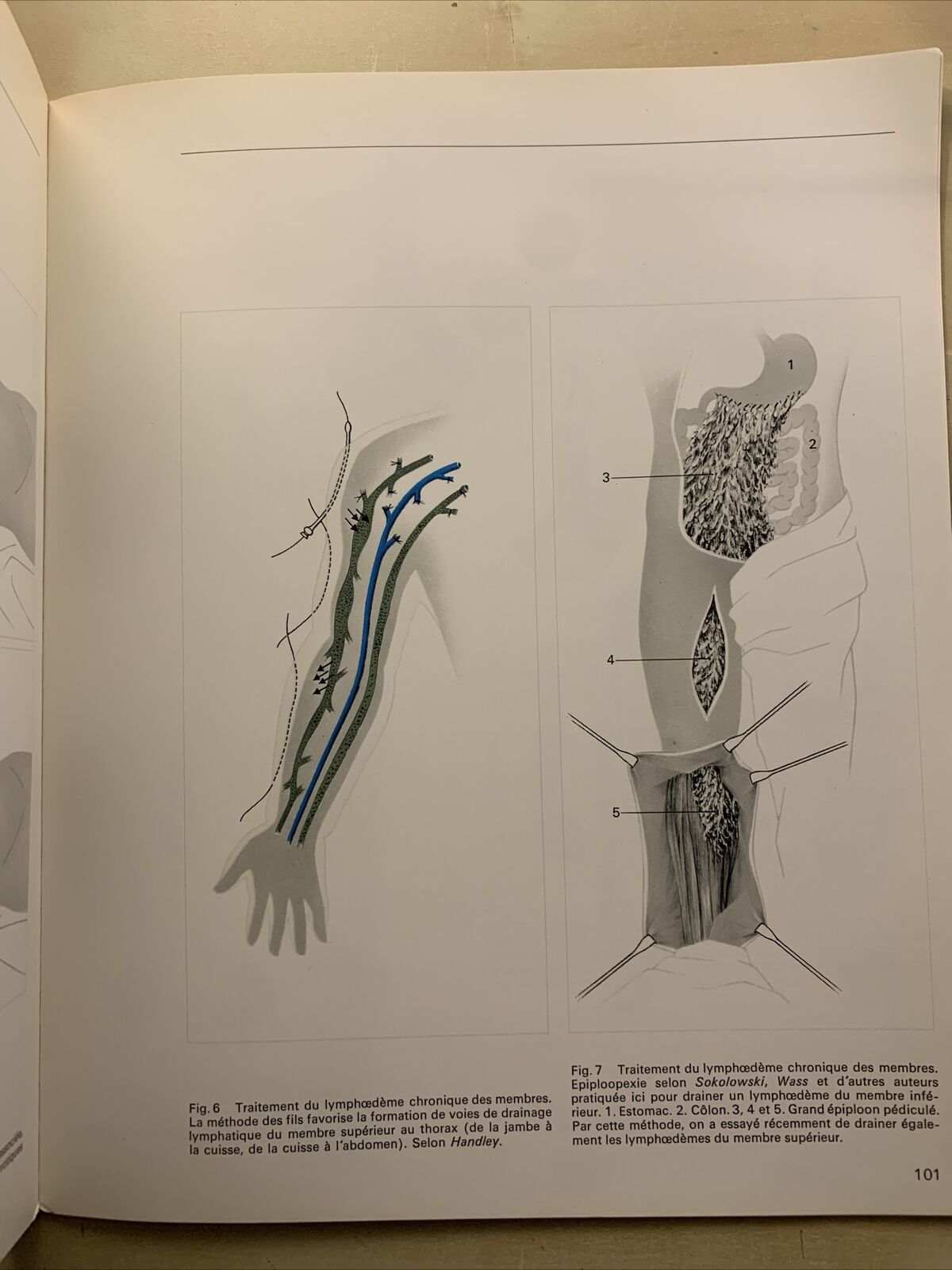 FORUM MEDICI - LES MÉDICINS PARLENT AU MÉDECIN, No 14 La phlébologie et les doma