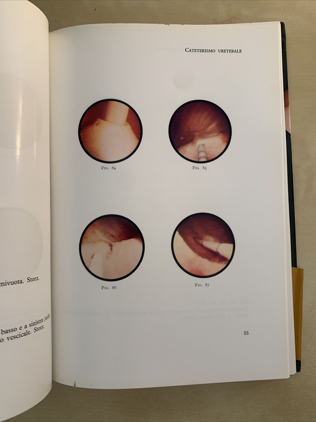 UROLOGIA ENDOSCOPICA - Rocca Rossetti, Usai, Binaghi. Editrice Universo 1970 #