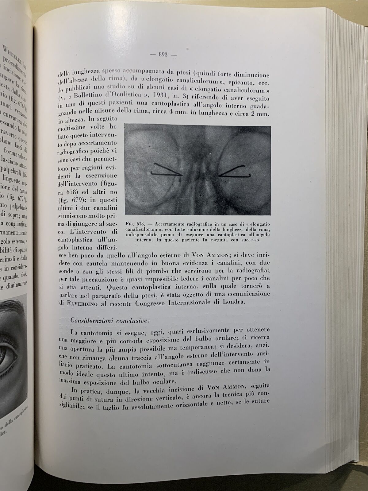 CHIRURGIA DELL'APPARATO OCULARE Volume secondo. E. LEONARDI. ARTE DELLA STAMPA #