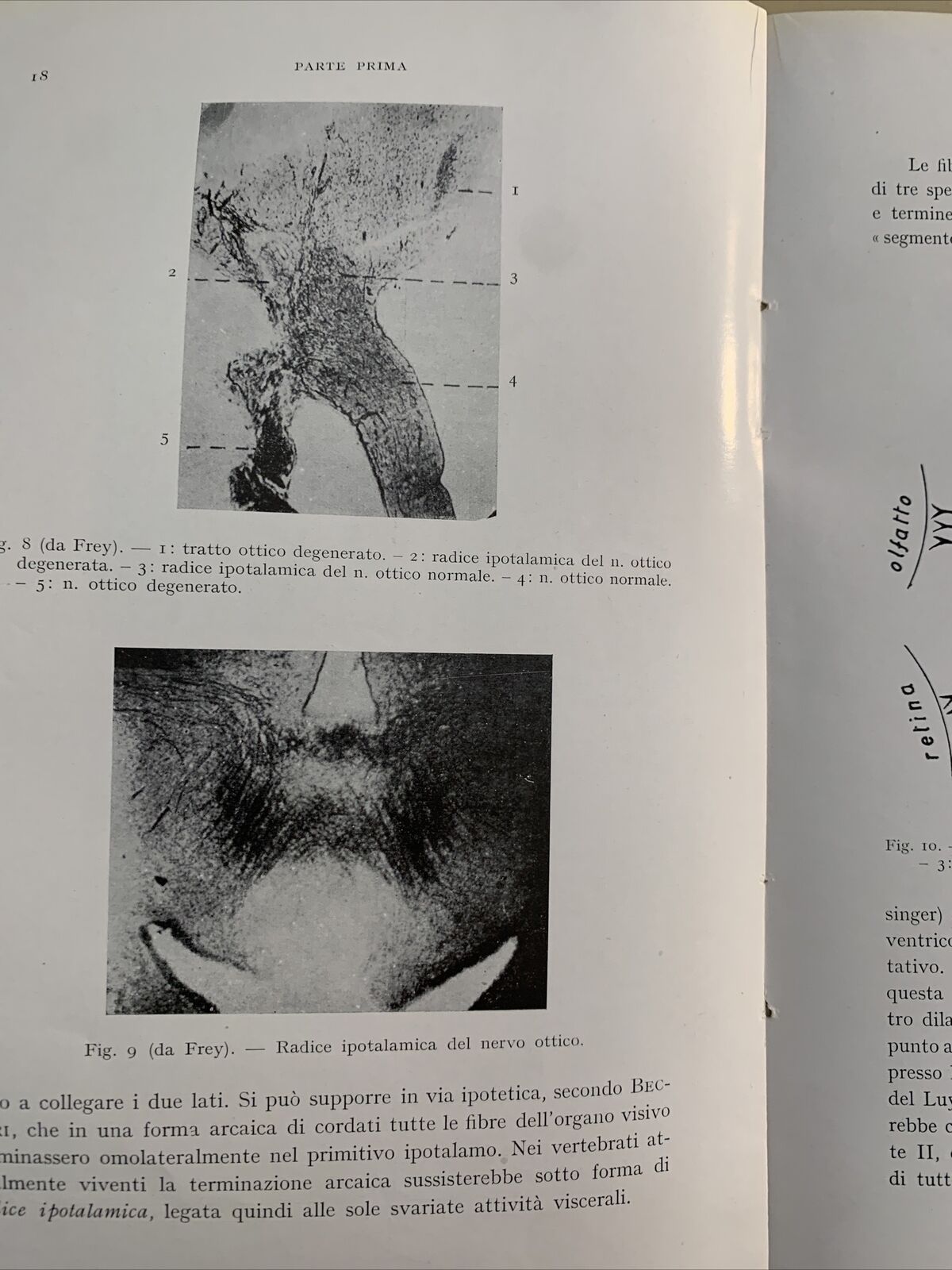 FISIOPATOLOGIA E CLINICA OCULO - DIENCEFALICA. Alajmo, Rubino 1952. Ariani #