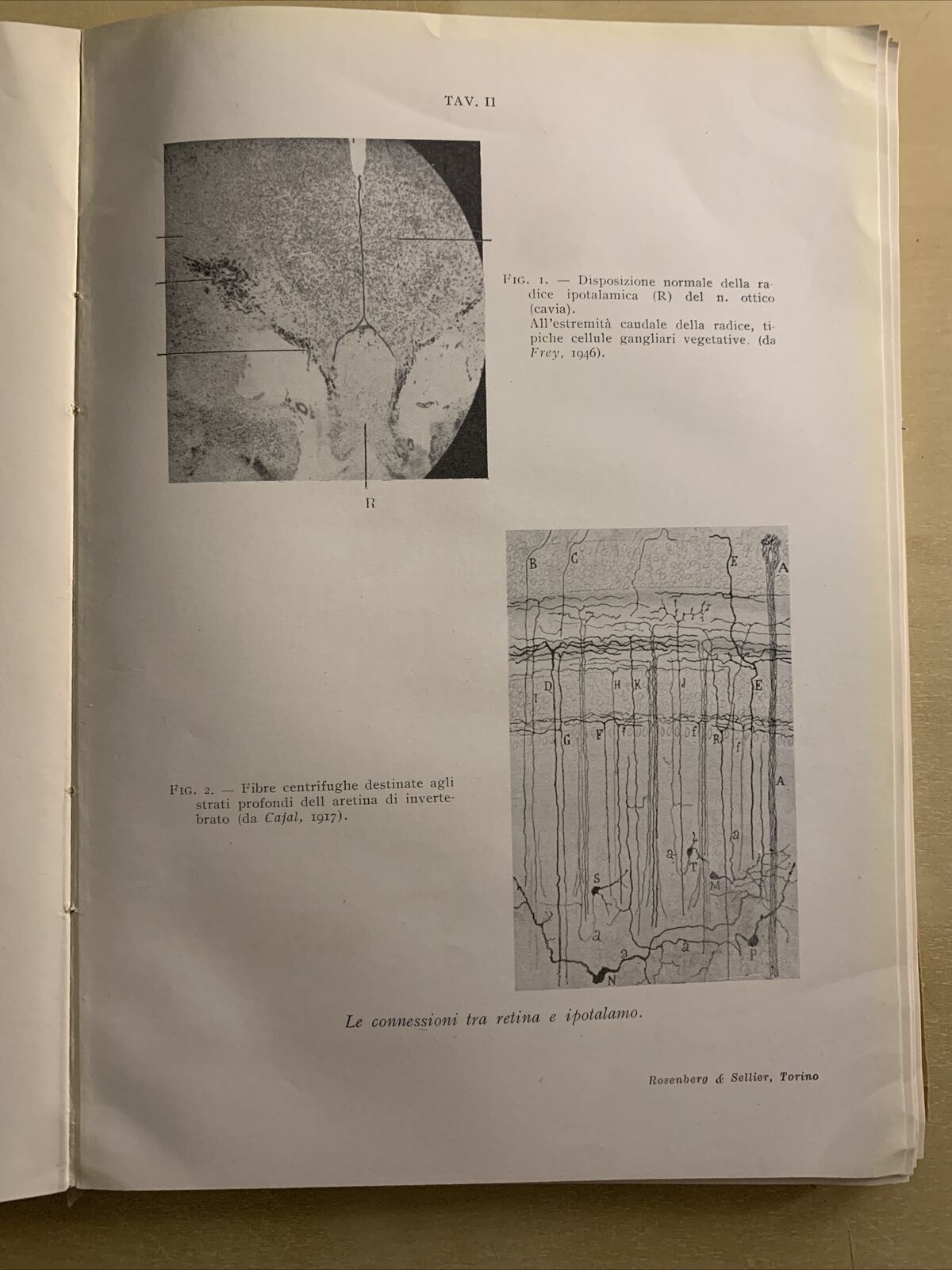 IL SISTEMA NERVOSO AUTONOMO NELLA FISIOPATOLOGIA OCULARE - MATTEUCCI. Rosenberg#