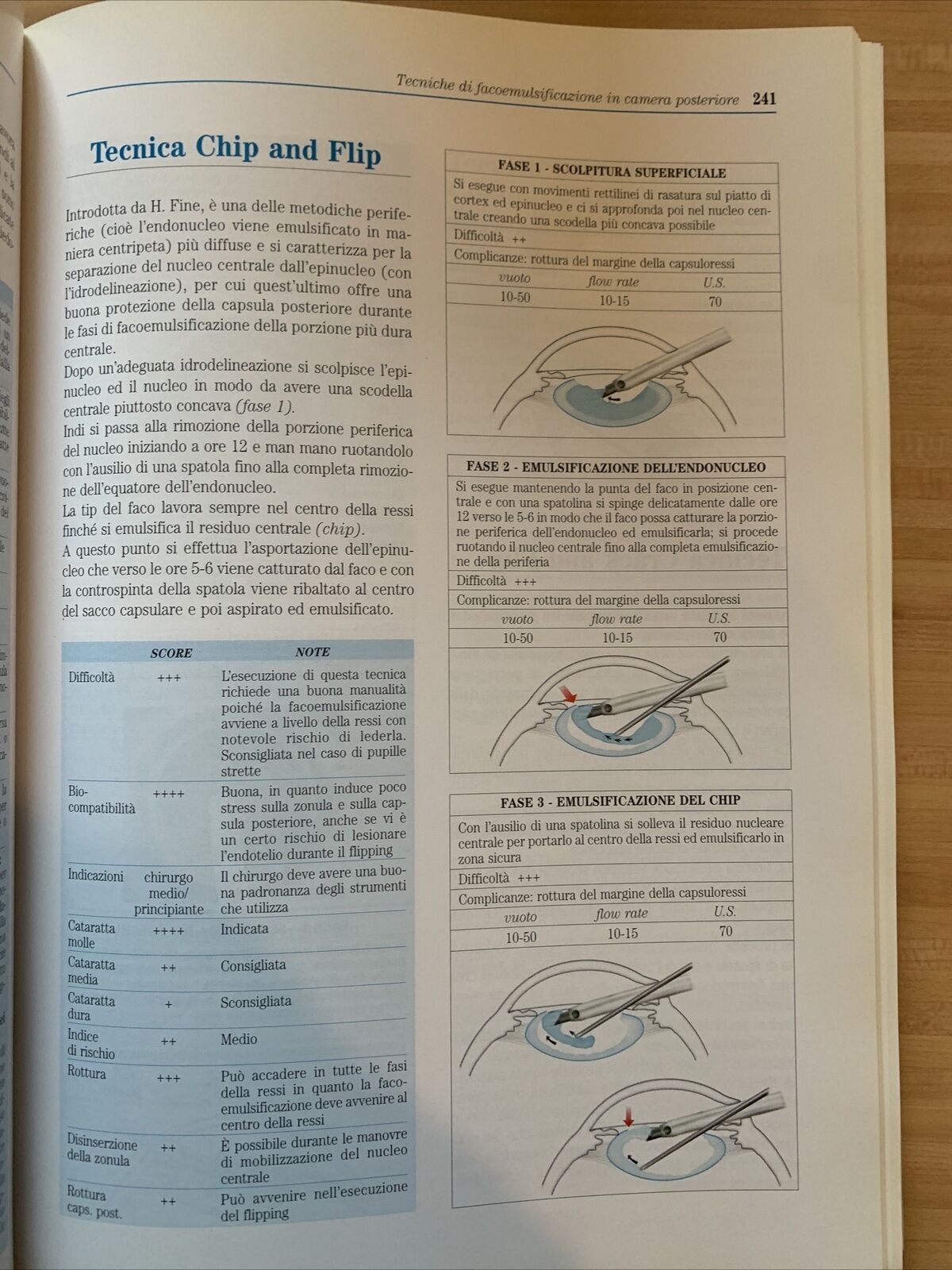 CATARATTA fisiopatologia del cristallino chirurgia della Cataratta.Fabiano 1999