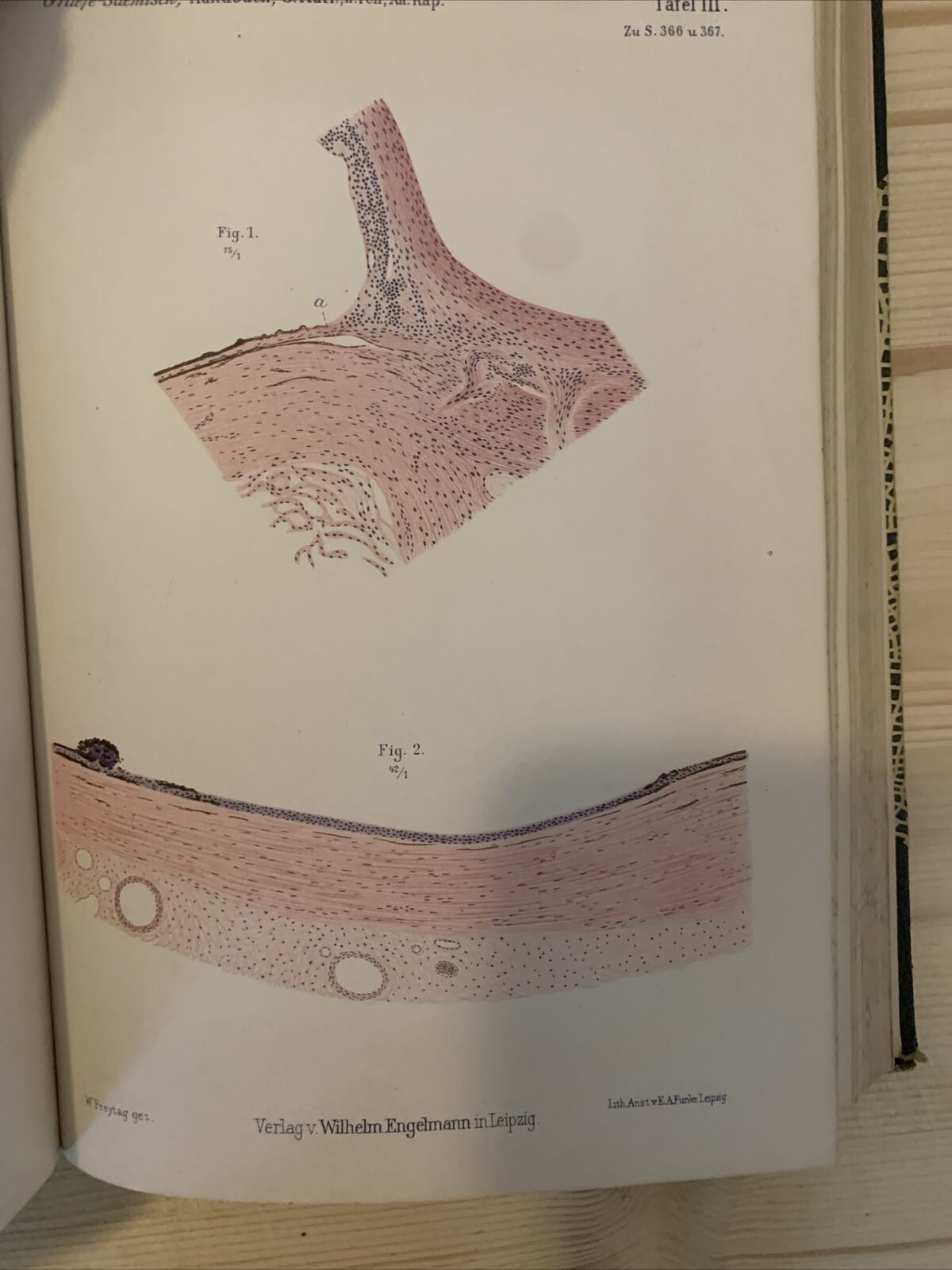graeffe saemisch handbuch der gesamen augenheilkunde 1910 #