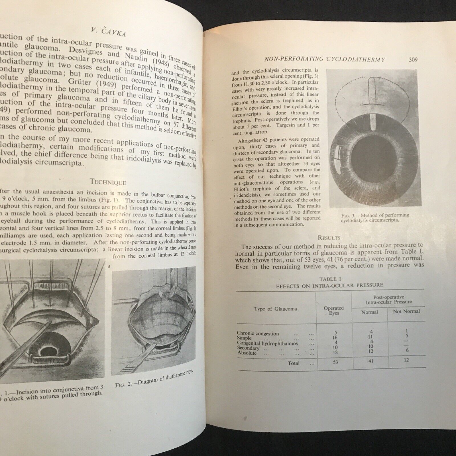 BRITISH JOURNAL OF OPHTHALMOLOGY, oftalmologia. Stewart Duke-Elder 1951 vol XXXV
