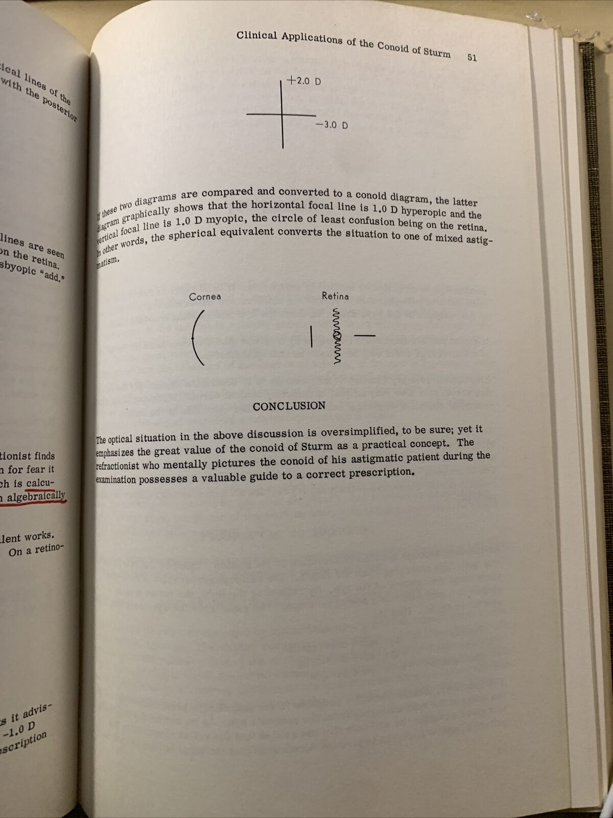 MANUAL OF REFRACTION - ALBERT E. SLOANE  1961 #