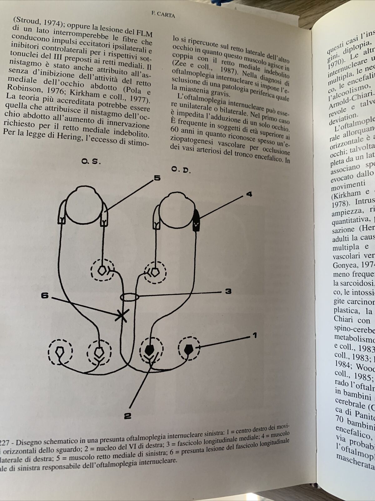 NEUROFTALMOLOGIA - FRANCESCO CARTA, EDIZIONI SBM 1997 #