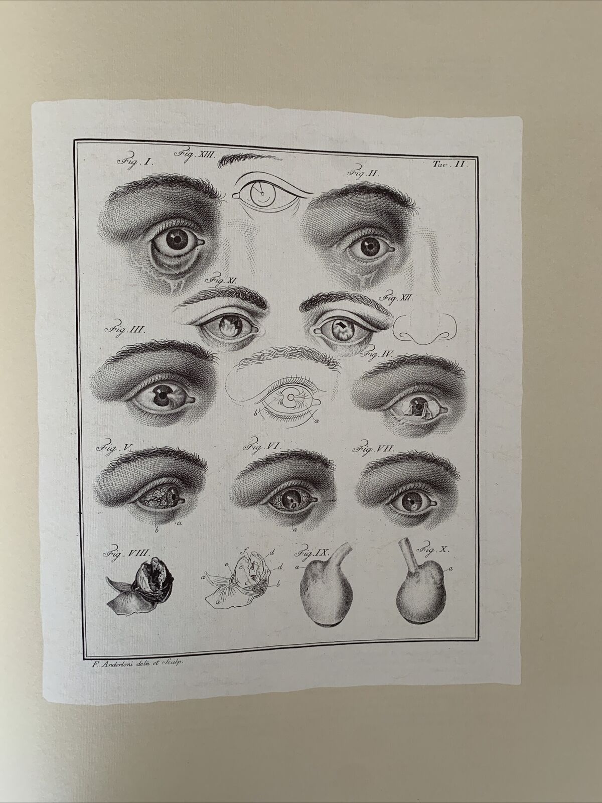 Icones ophthalmologicae - Francesco Loperfido - Casa editrice Mattioli 1992 #