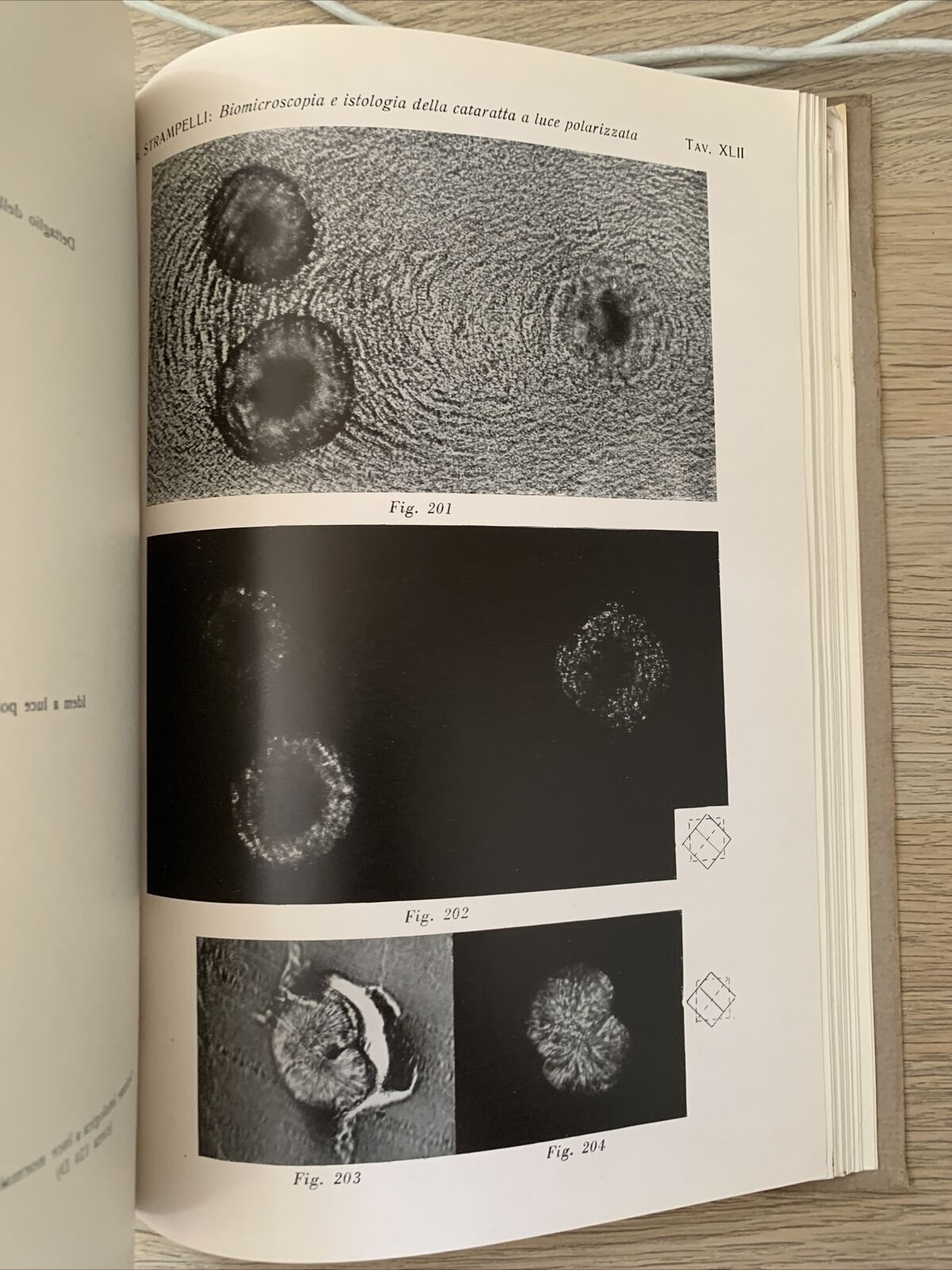 BIOMICROSCOPIA ED ISTOLOGIA DELLA CATARATTA A LUCE POLARIZZATA - Strampelli 1934