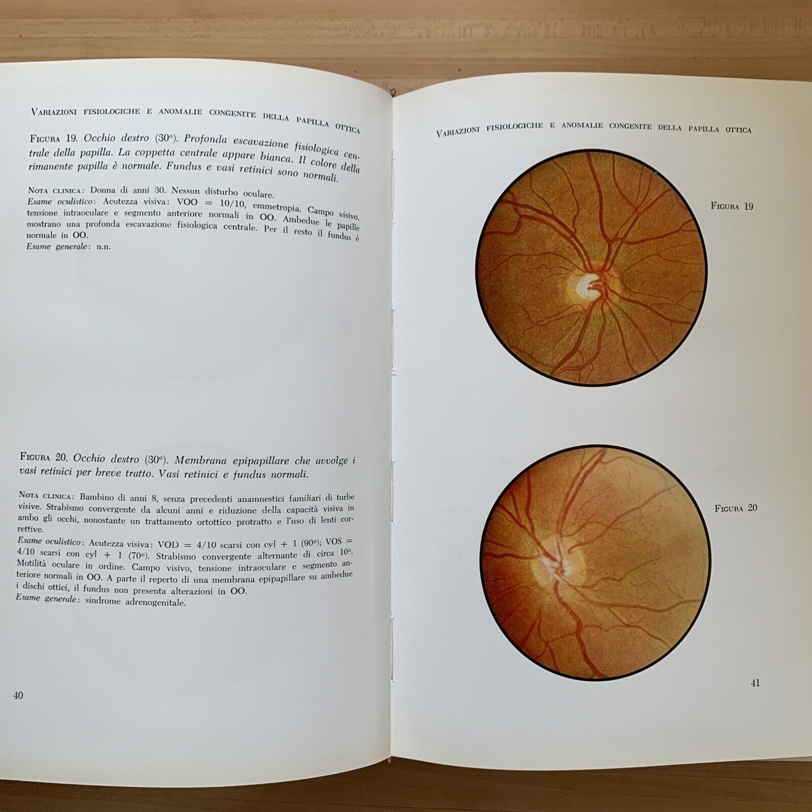 ATLANTE DEL FONDO DELL'OCCHIO - H. W. LARSEN. Luigi Russo editore 1964