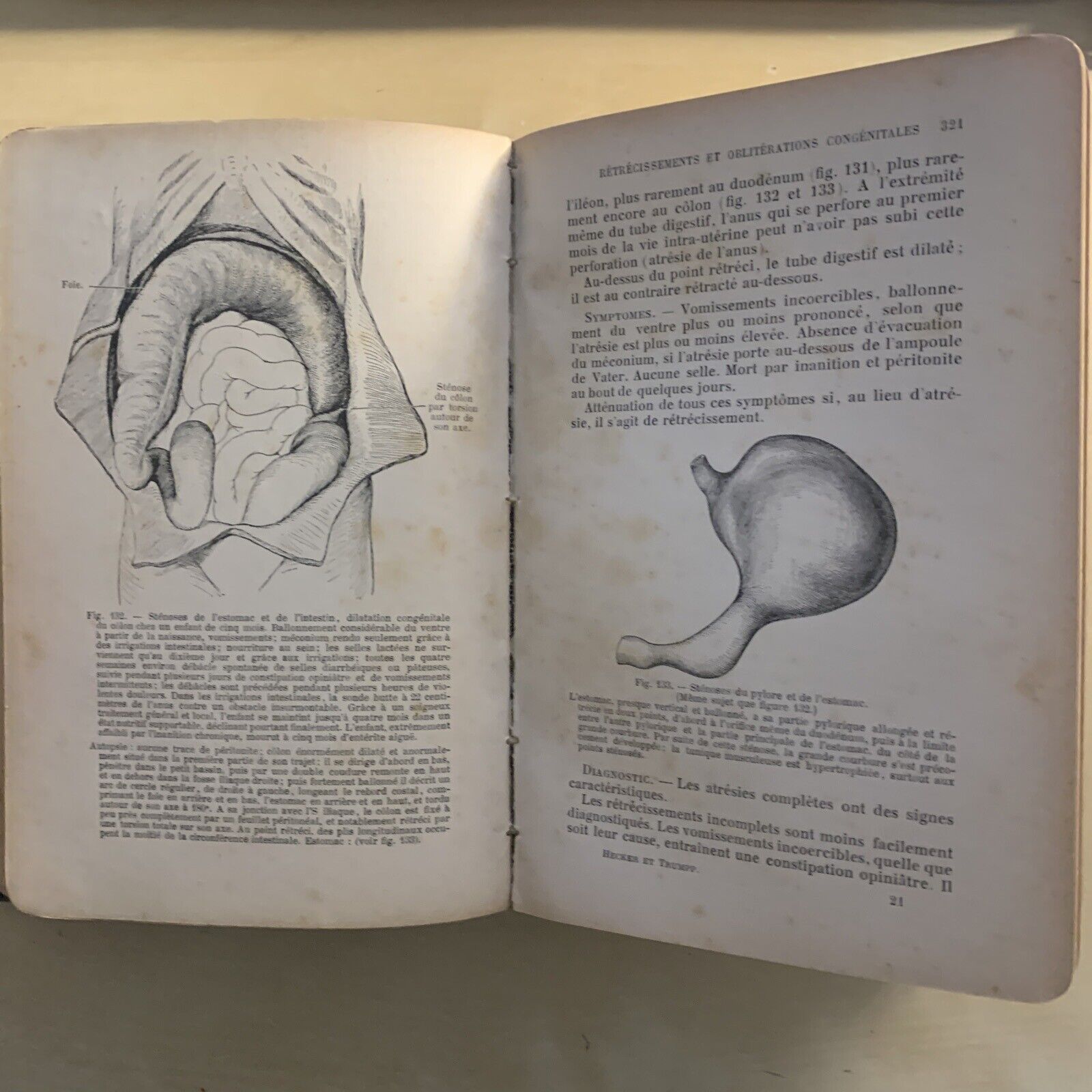 ATLAS MANUEL MALADIES DES ENFANTS. Hecker Trump Apert. Baillière & Fils 1906 #