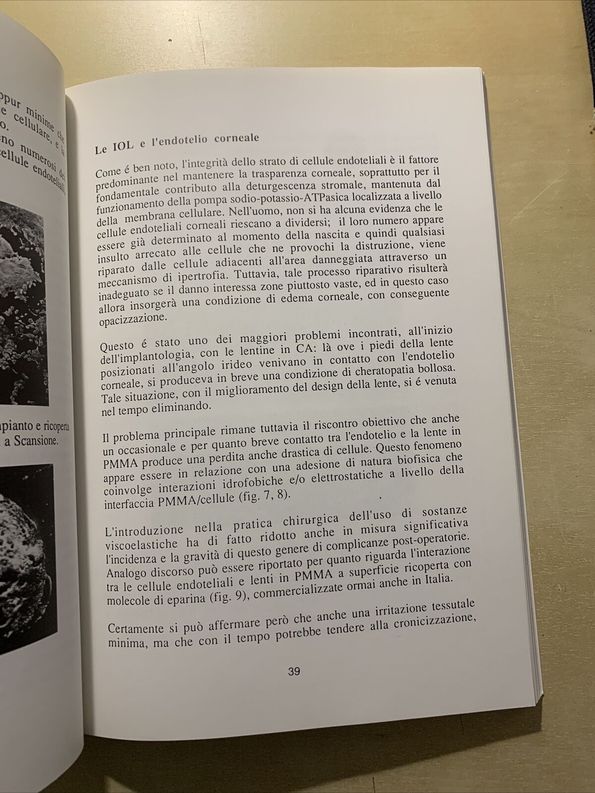 COME APRIRE GLI OCCHI SULLE IOL - CAVINA, M. GATTI, P. VERSURA, S. VOLANTI #